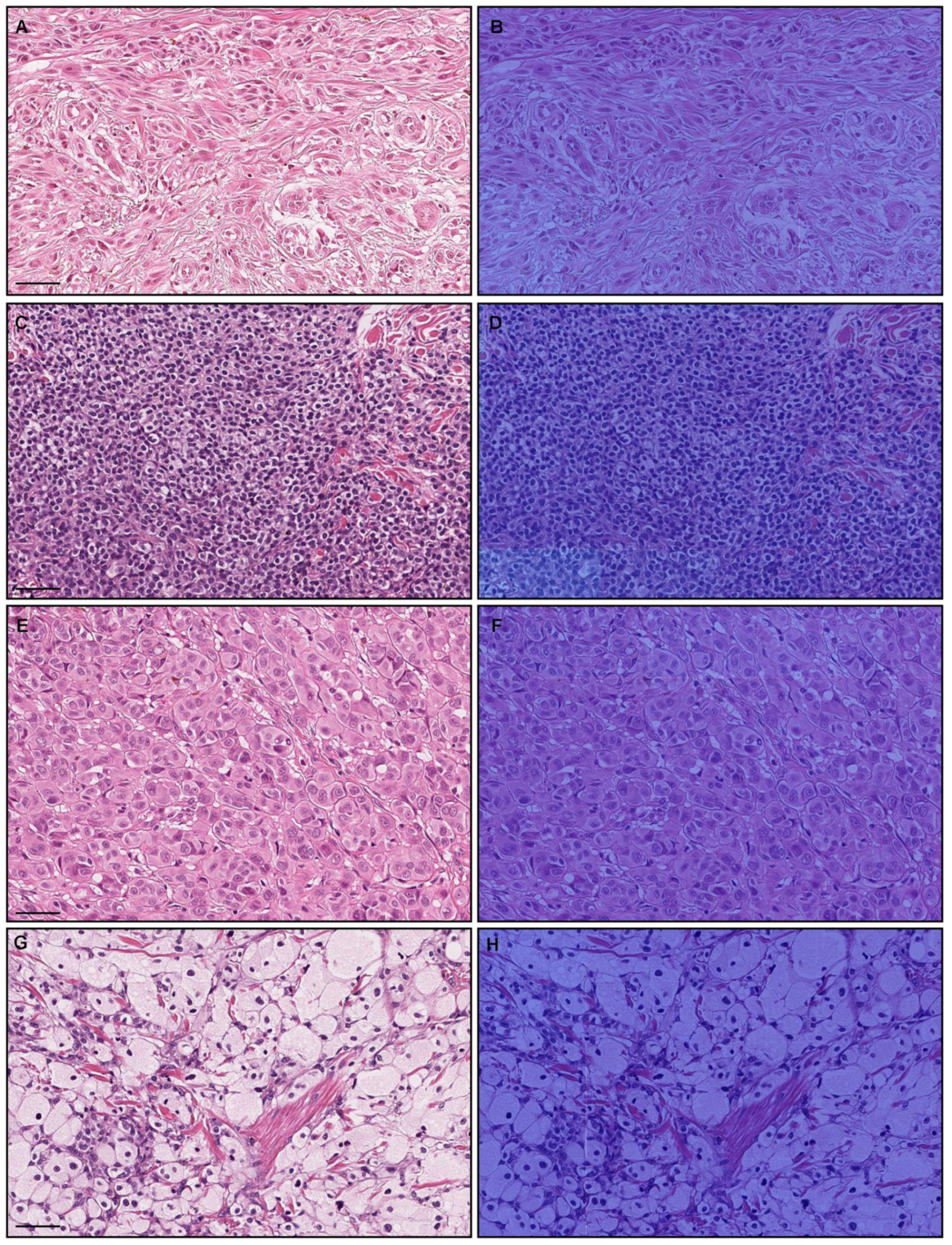 Cancers 15 01907 g008 Cancers 15 01907 g008