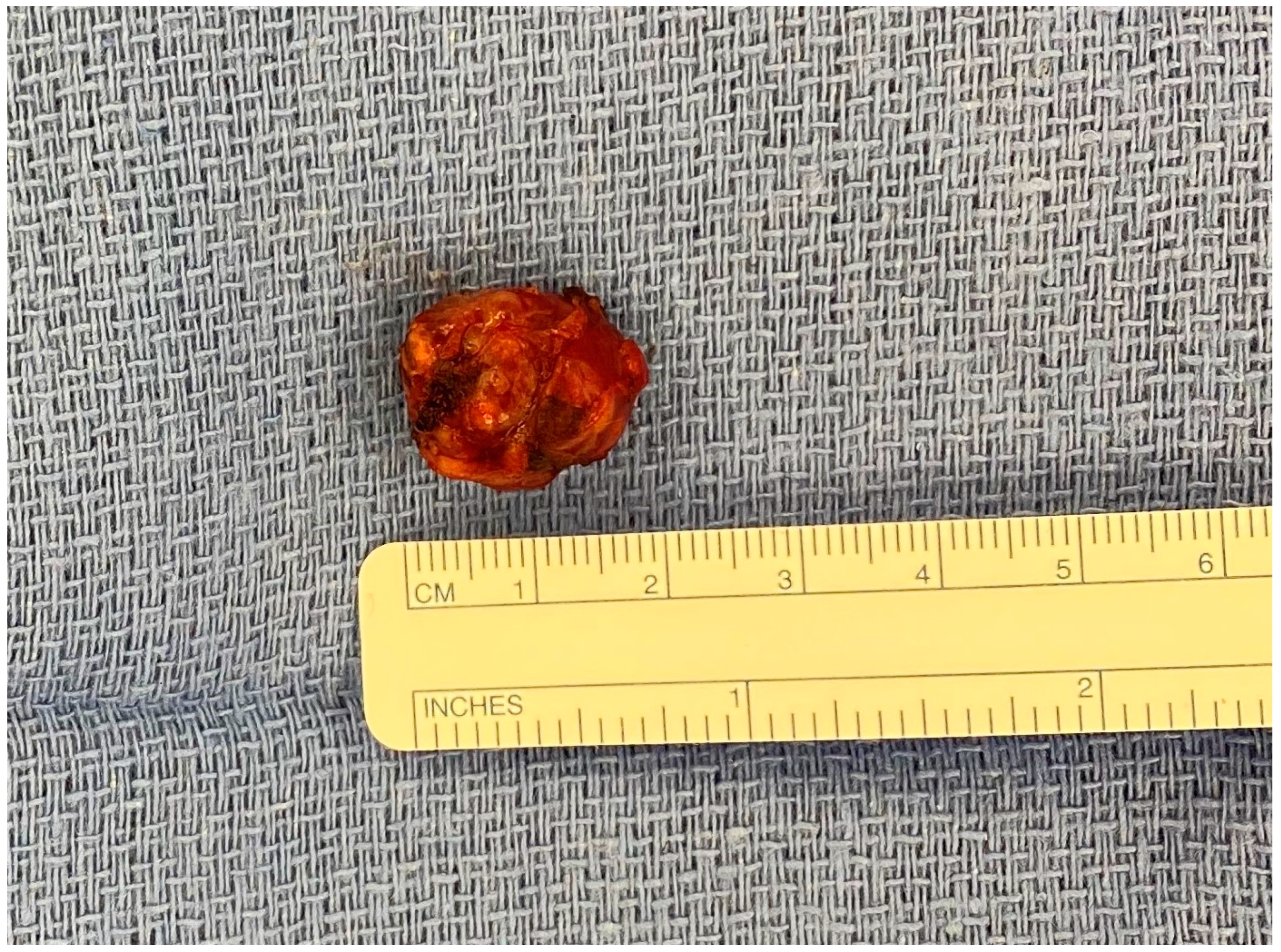 Cancers 15 02006 g003 Cancers 15 02006 g003