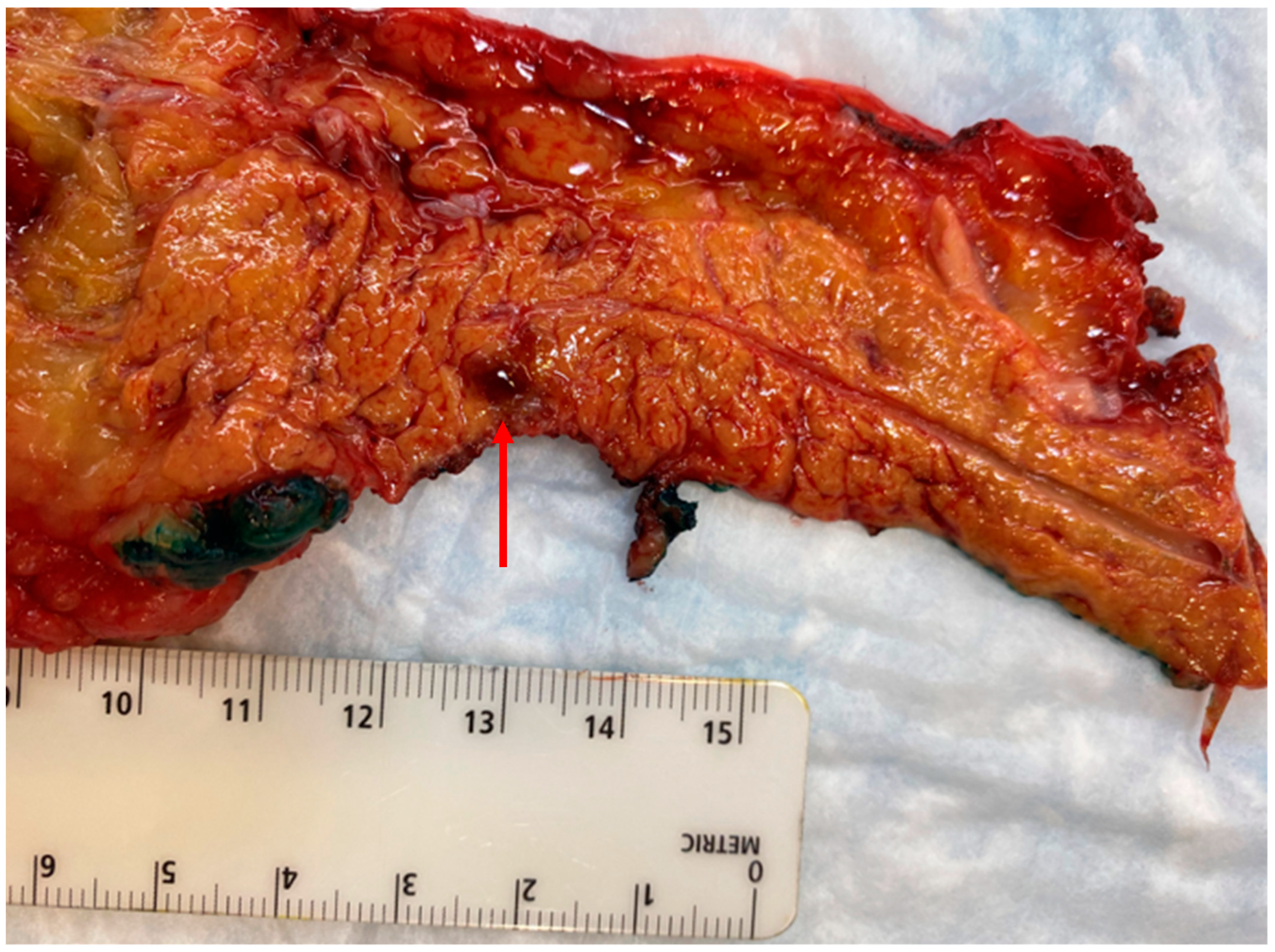 Cancers 15 02006 g004 Cancers 15 02006 g004