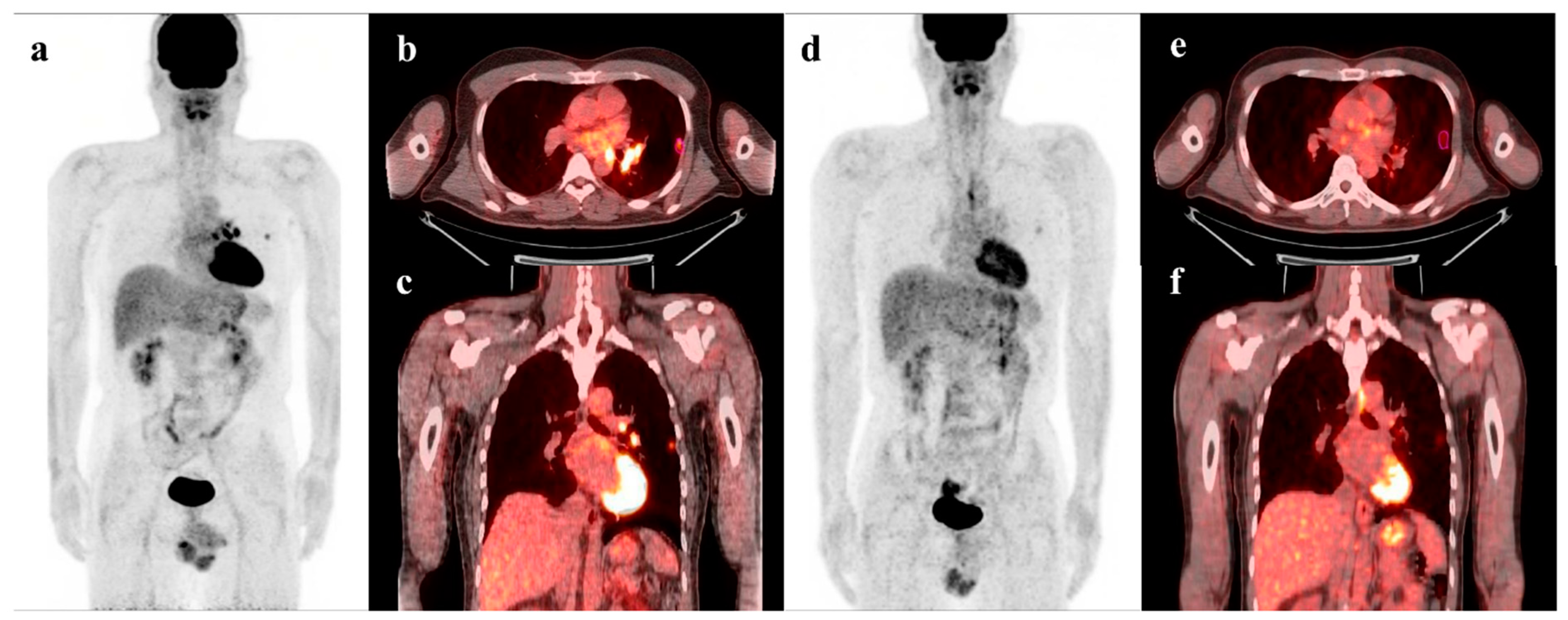 Cancers 15 02012 g005 Cancers 15 02012 g005
