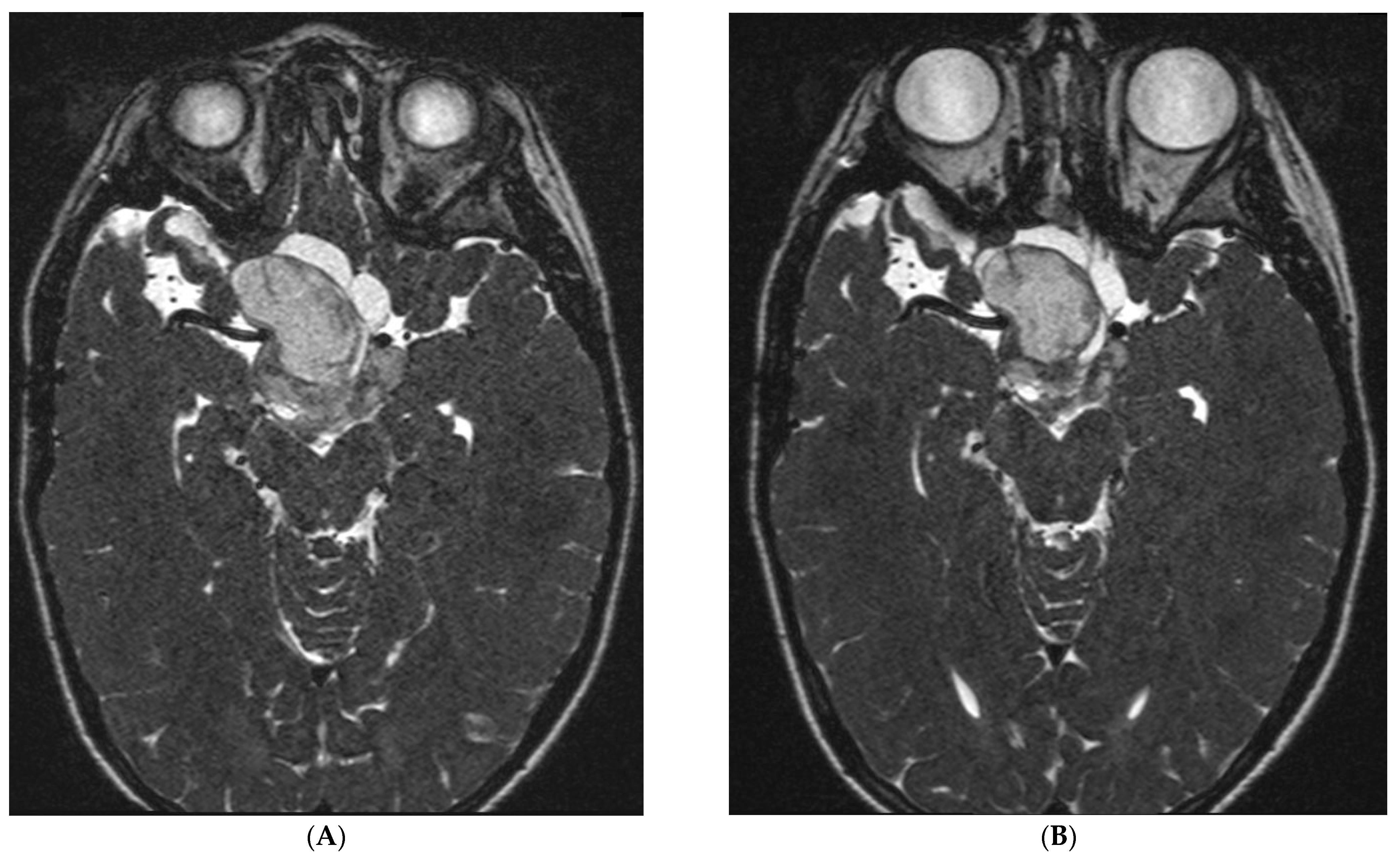 Cancers 15 02020 g003 Cancers 15 02020 g003