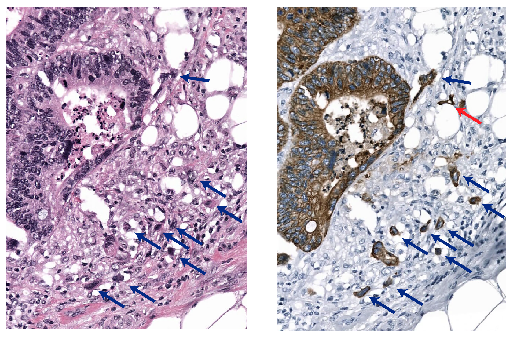 Cancers 15 02079 g001