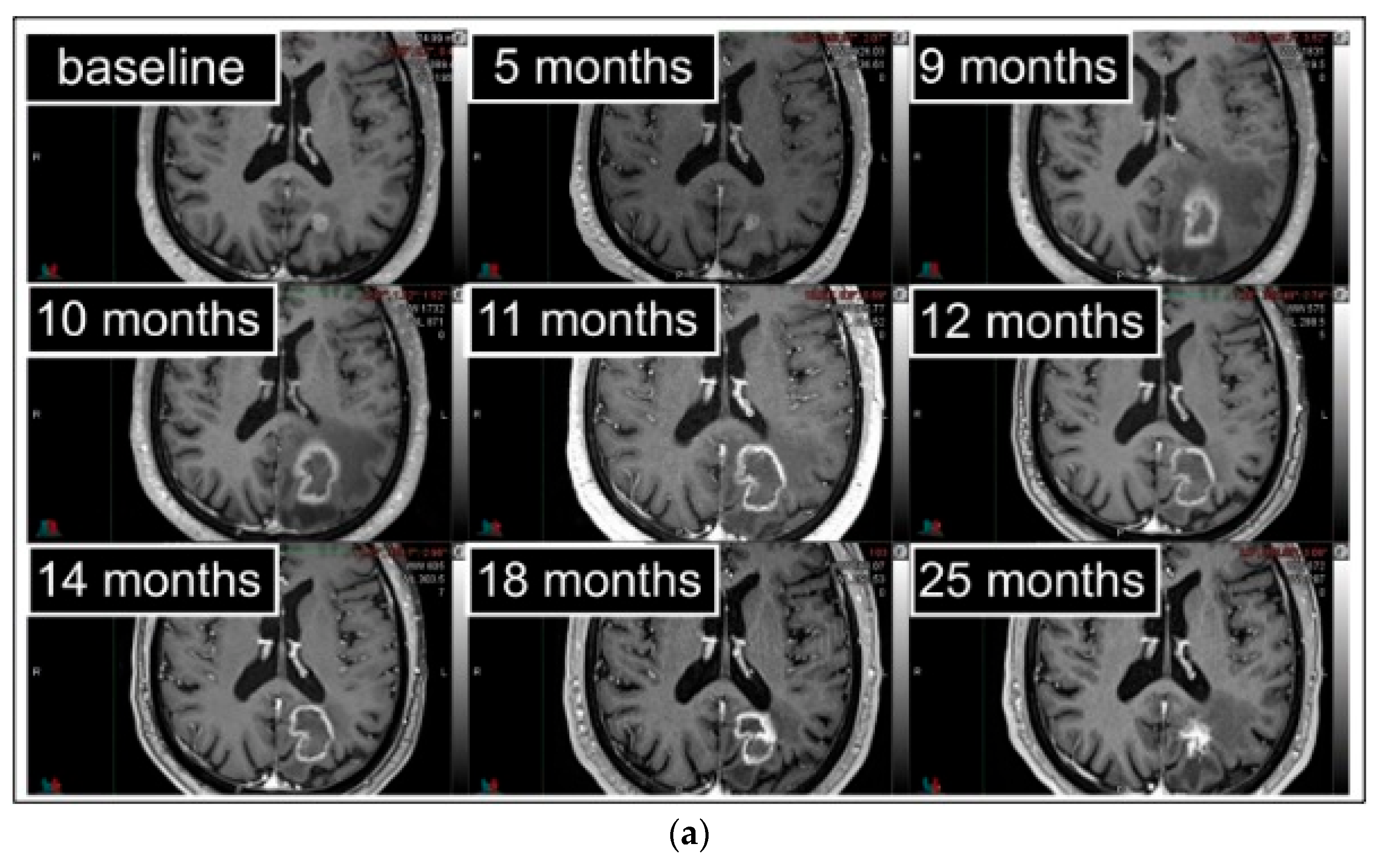 Cancers 15 02094 g003a Cancers 15 02094 g003a
