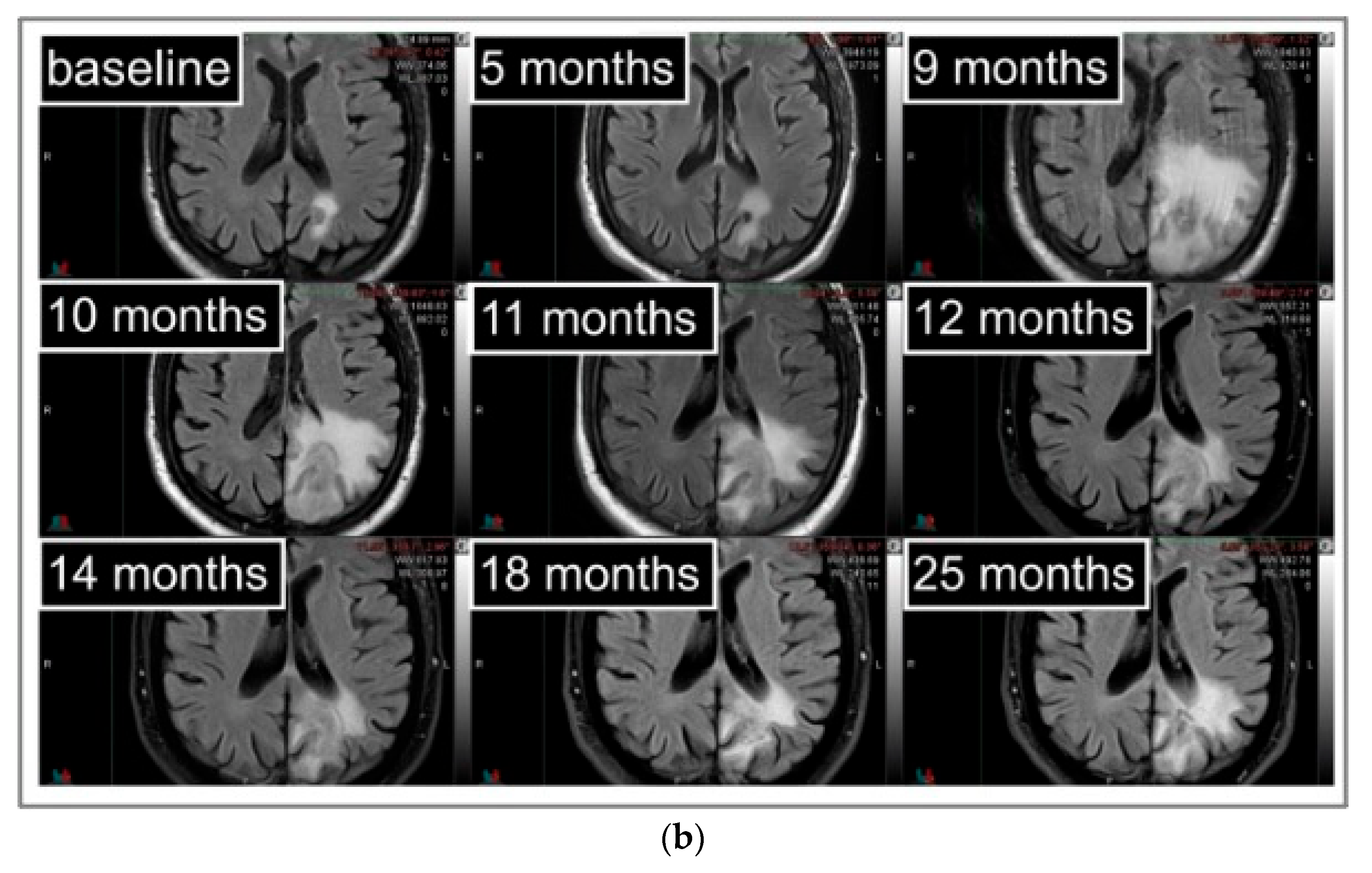 Cancers 15 02094 g003b Cancers 15 02094 g003b