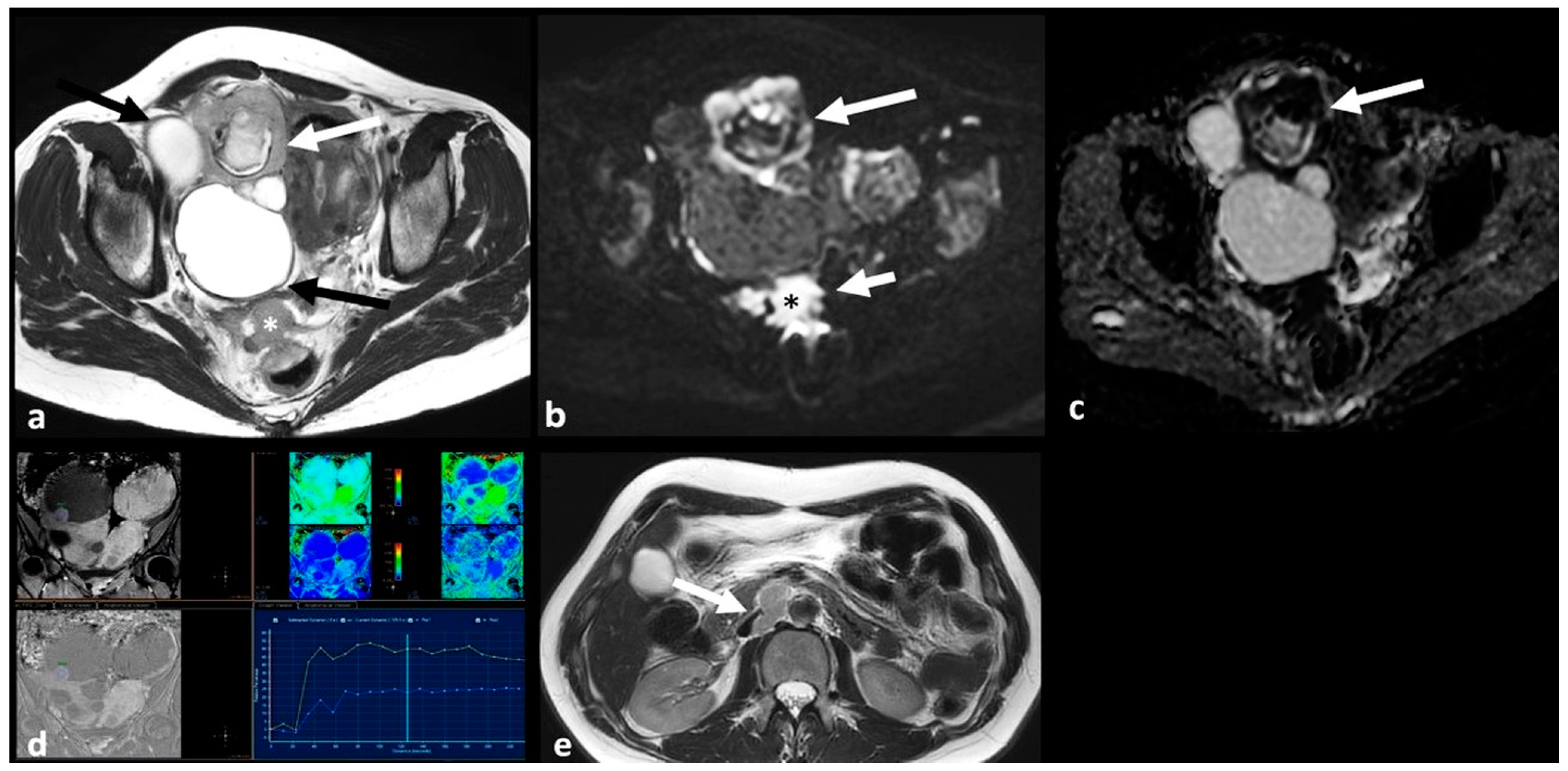 Cancers 15 02106 g003 Cancers 15 02106 g003