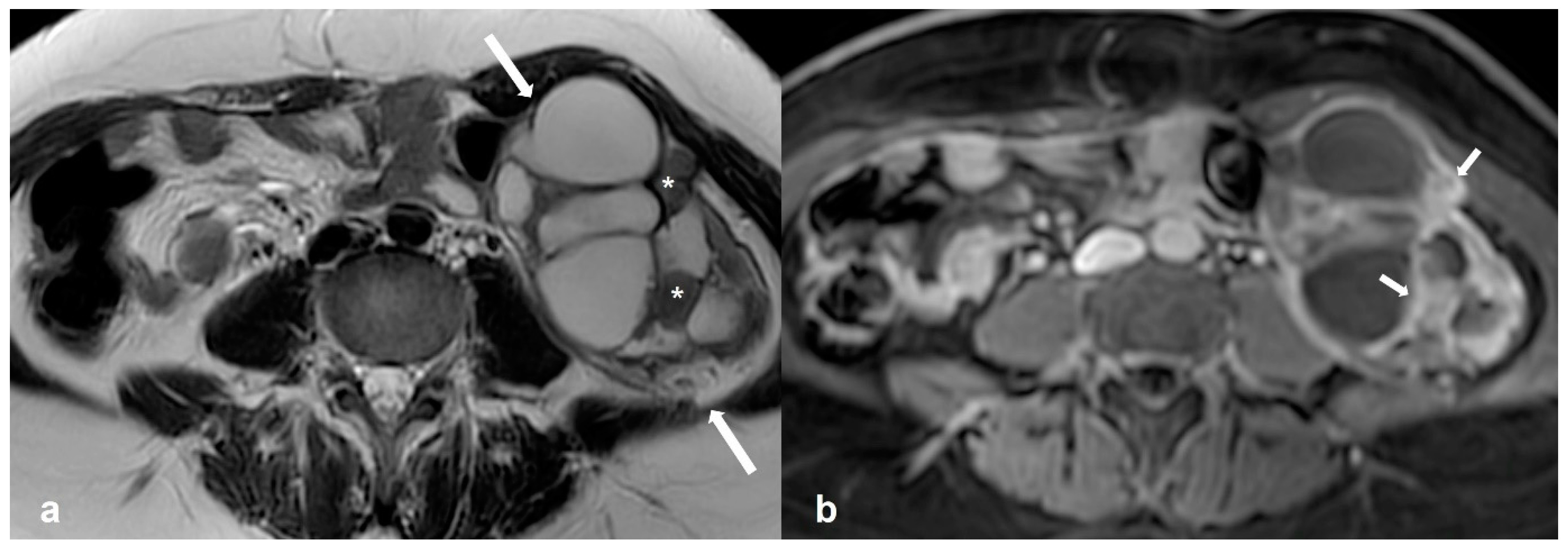 Cancers 15 02106 g004 Cancers 15 02106 g004