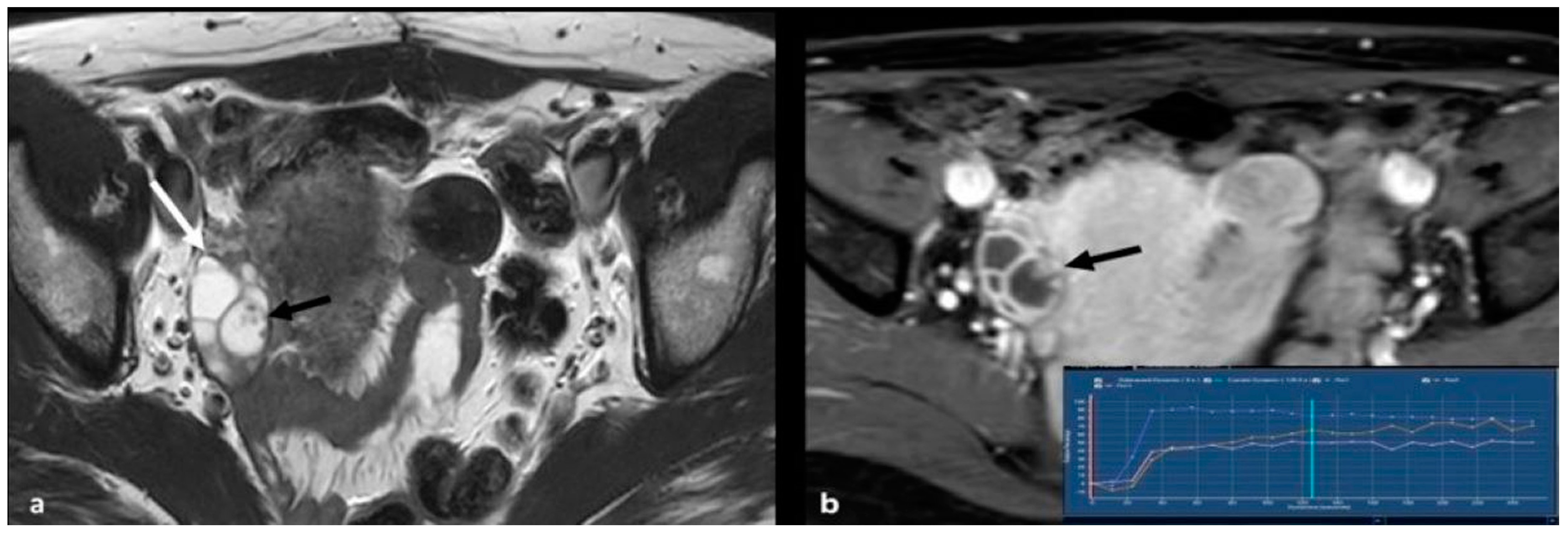 Cancers 15 02106 g005 Cancers 15 02106 g005