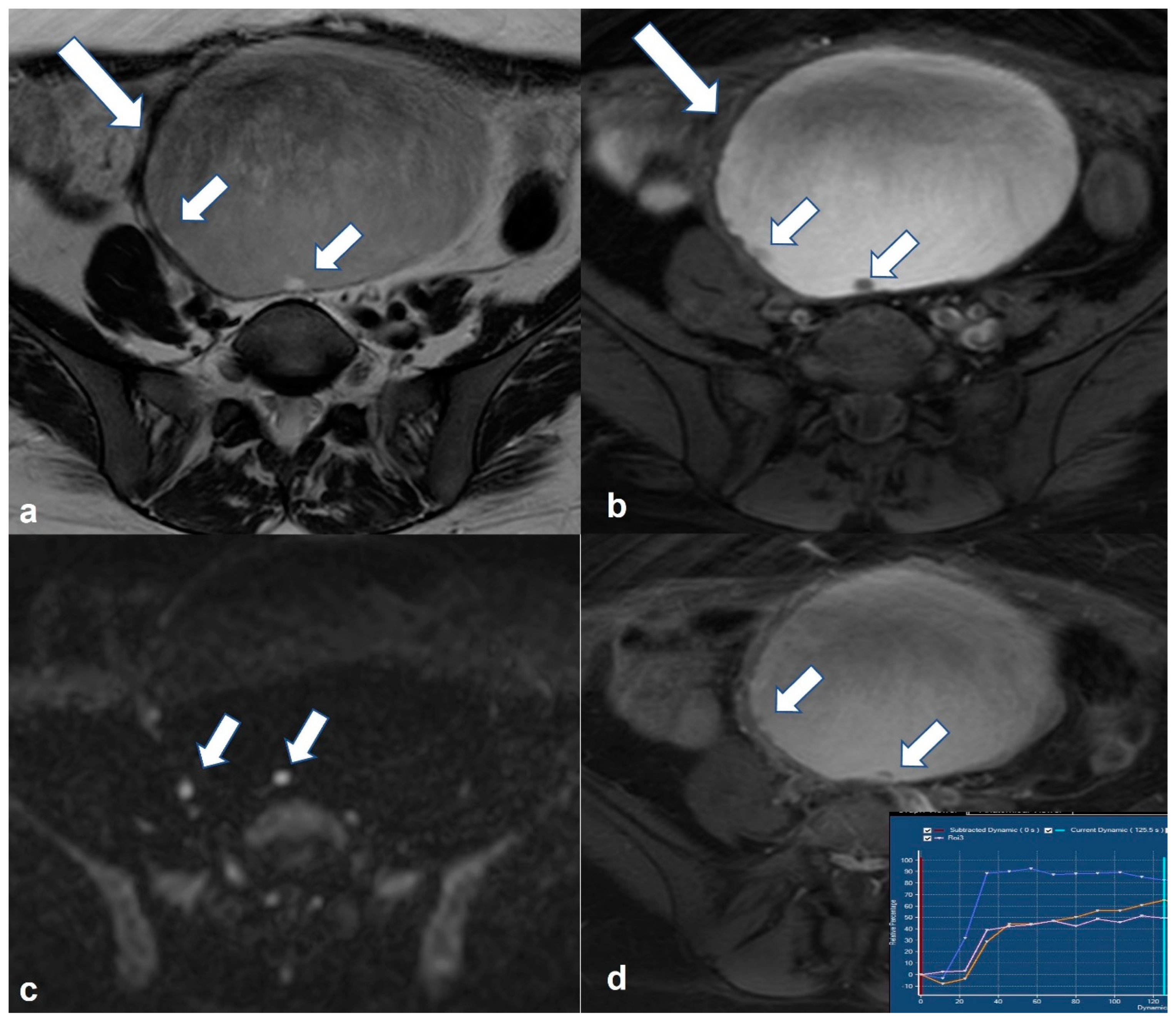 Cancers 15 02106 g007 Cancers 15 02106 g007