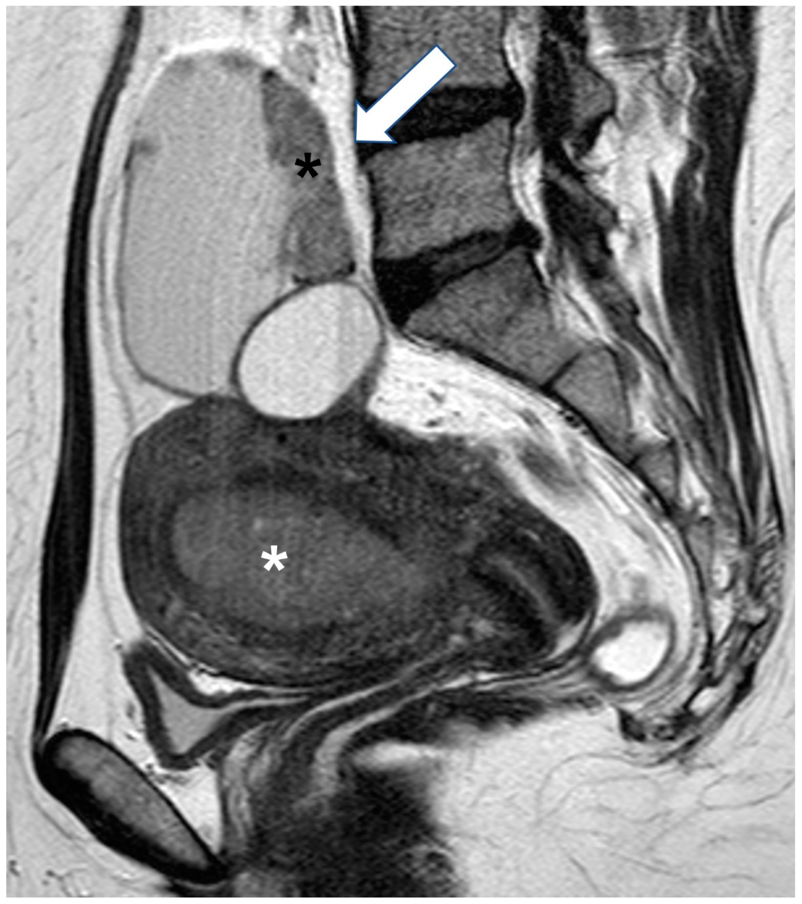 Cancers 15 02106 g008 Cancers 15 02106 g008