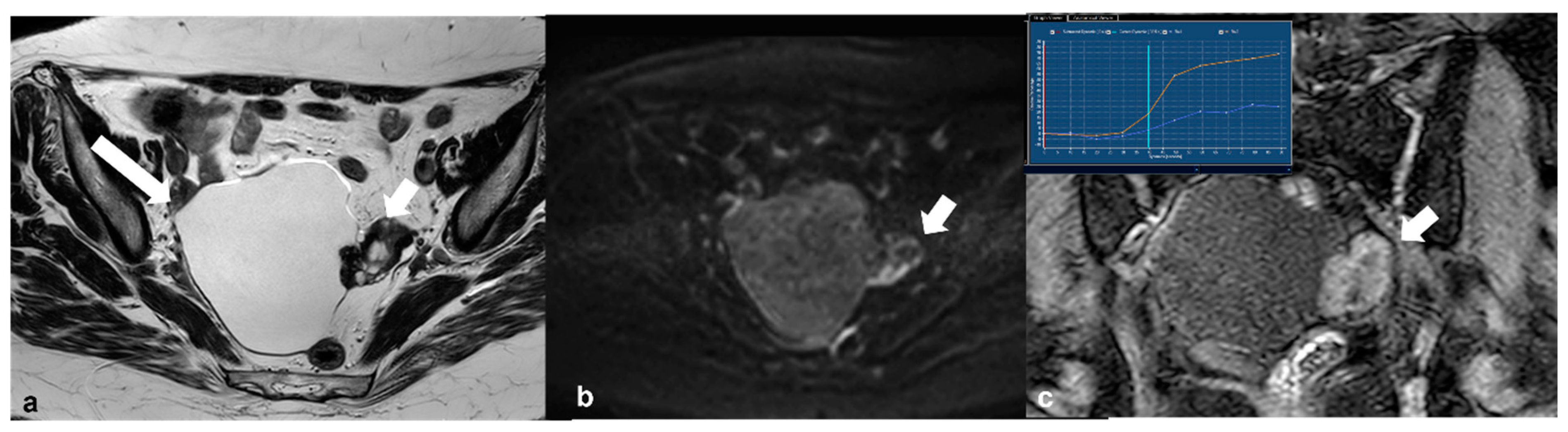 Cancers 15 02106 g009 Cancers 15 02106 g009