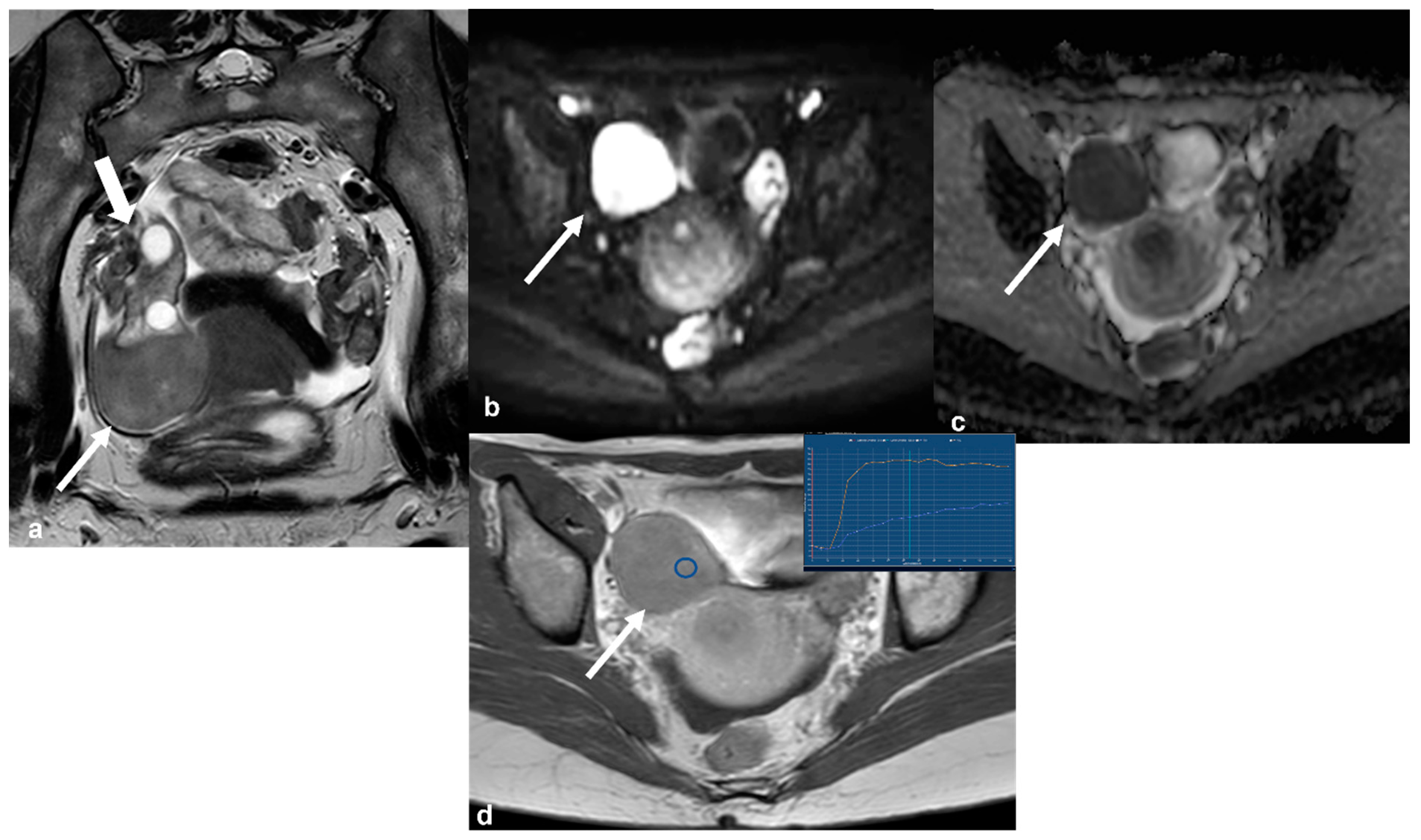 Cancers 15 02106 g010 Cancers 15 02106 g010