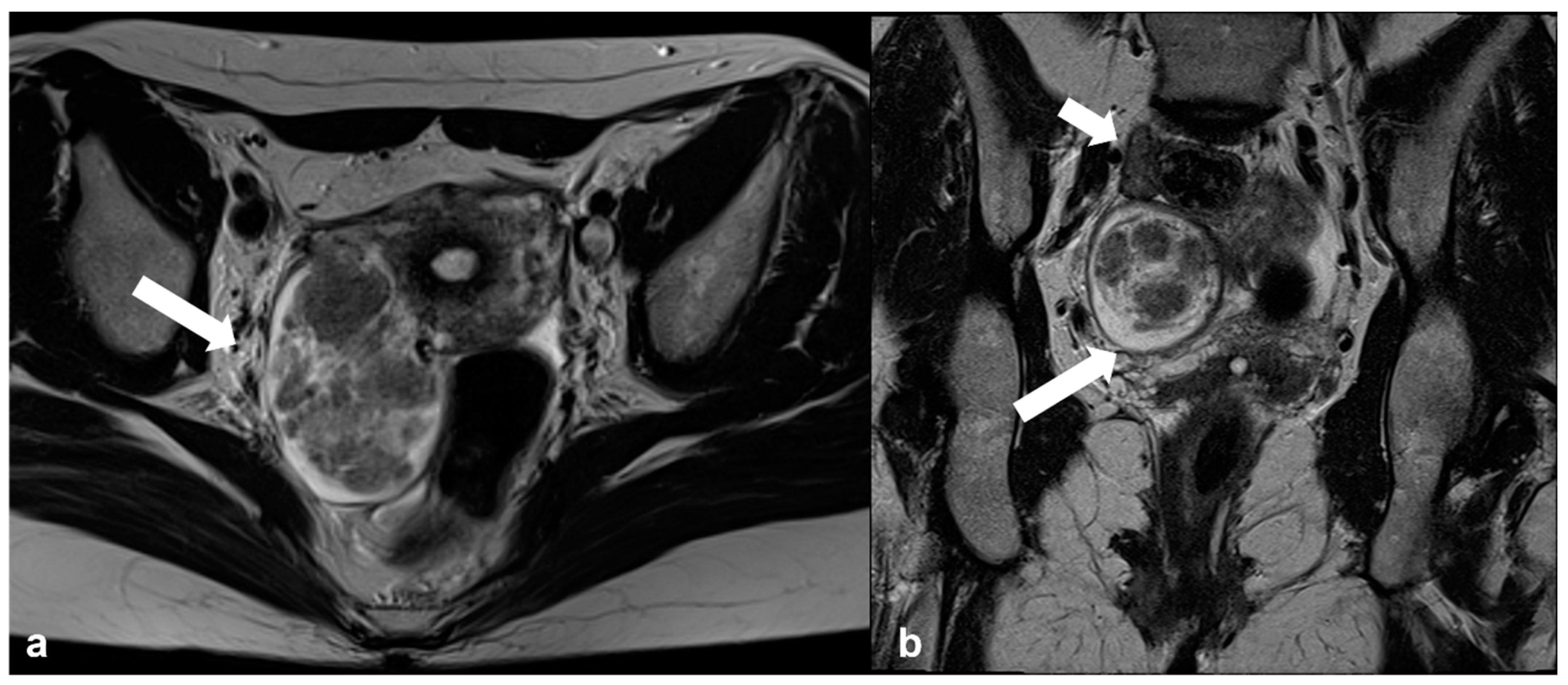 Cancers 15 02106 g011 Cancers 15 02106 g011
