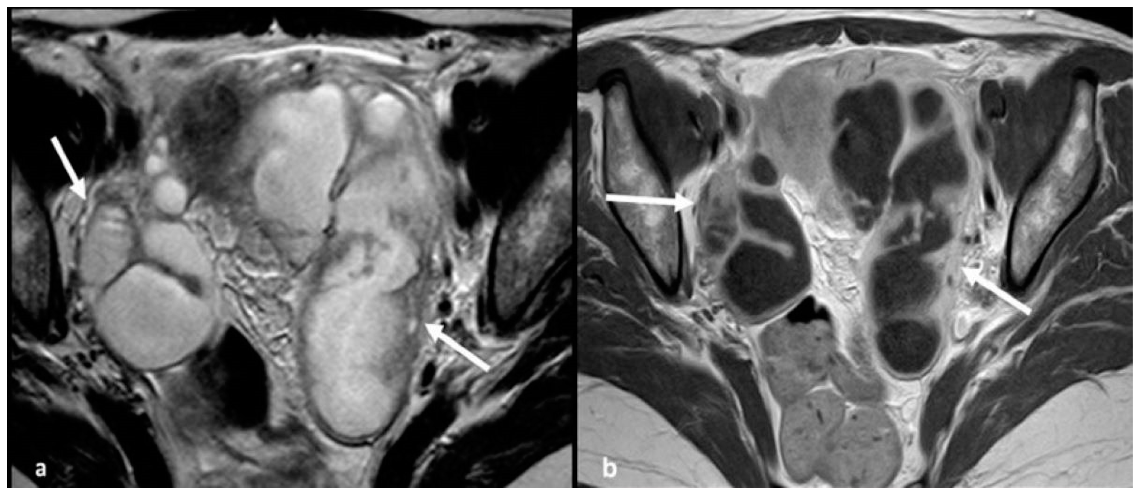 Cancers 15 02106 g012 Cancers 15 02106 g012