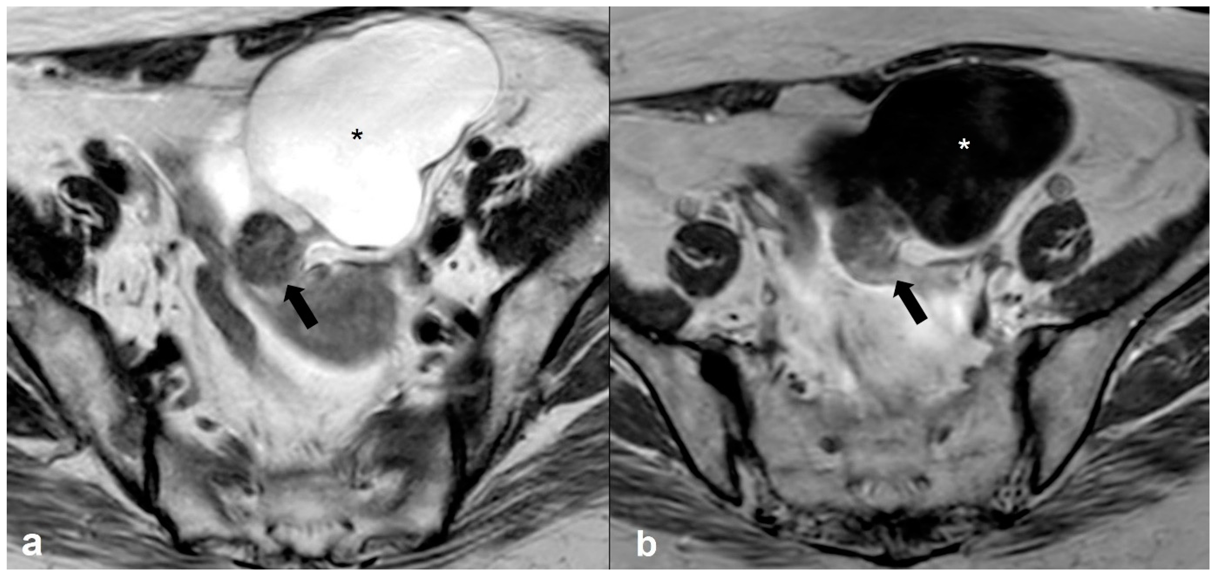 Cancers 15 02106 g014 Cancers 15 02106 g014