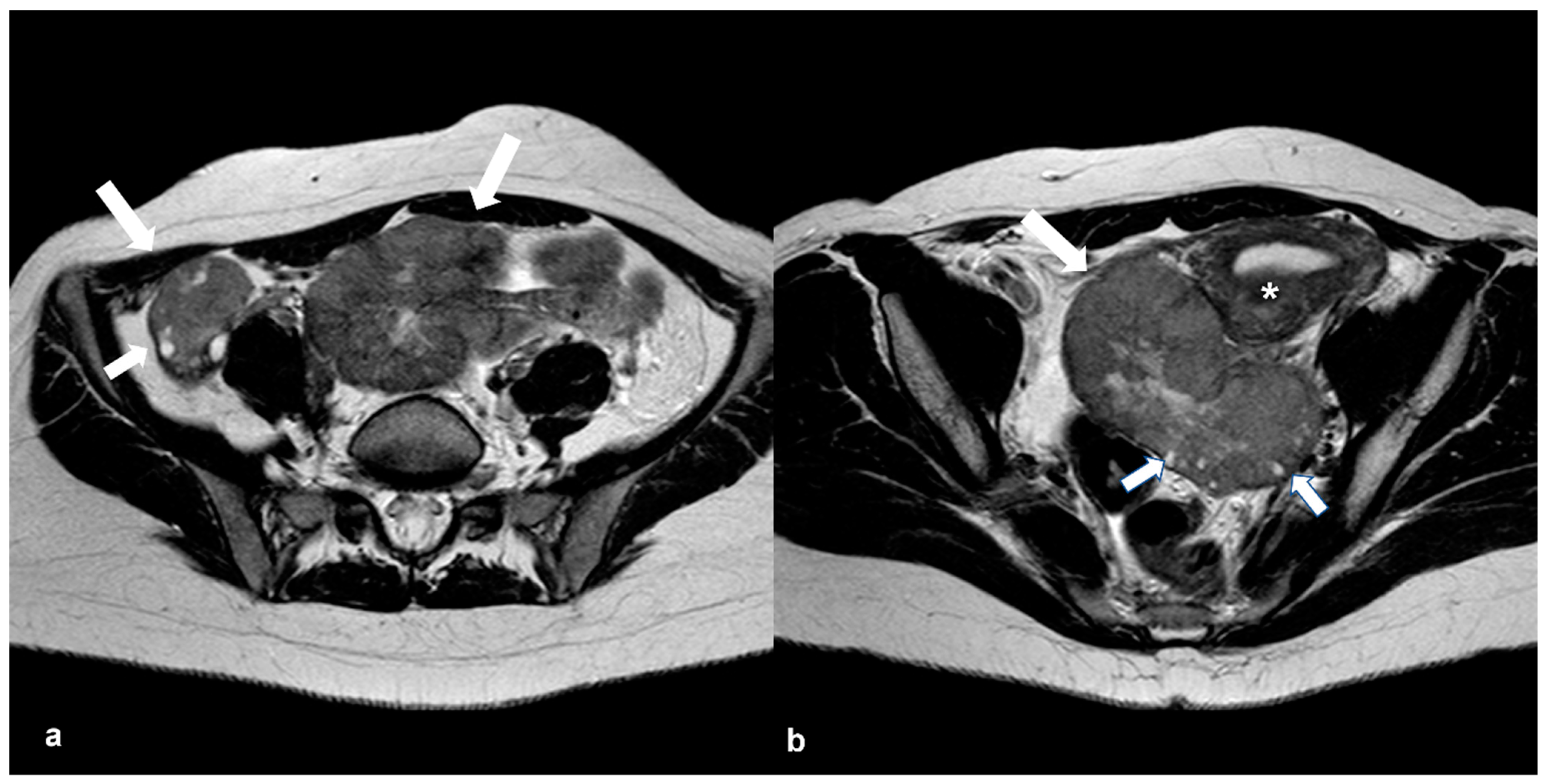 Cancers 15 02106 g015 Cancers 15 02106 g015