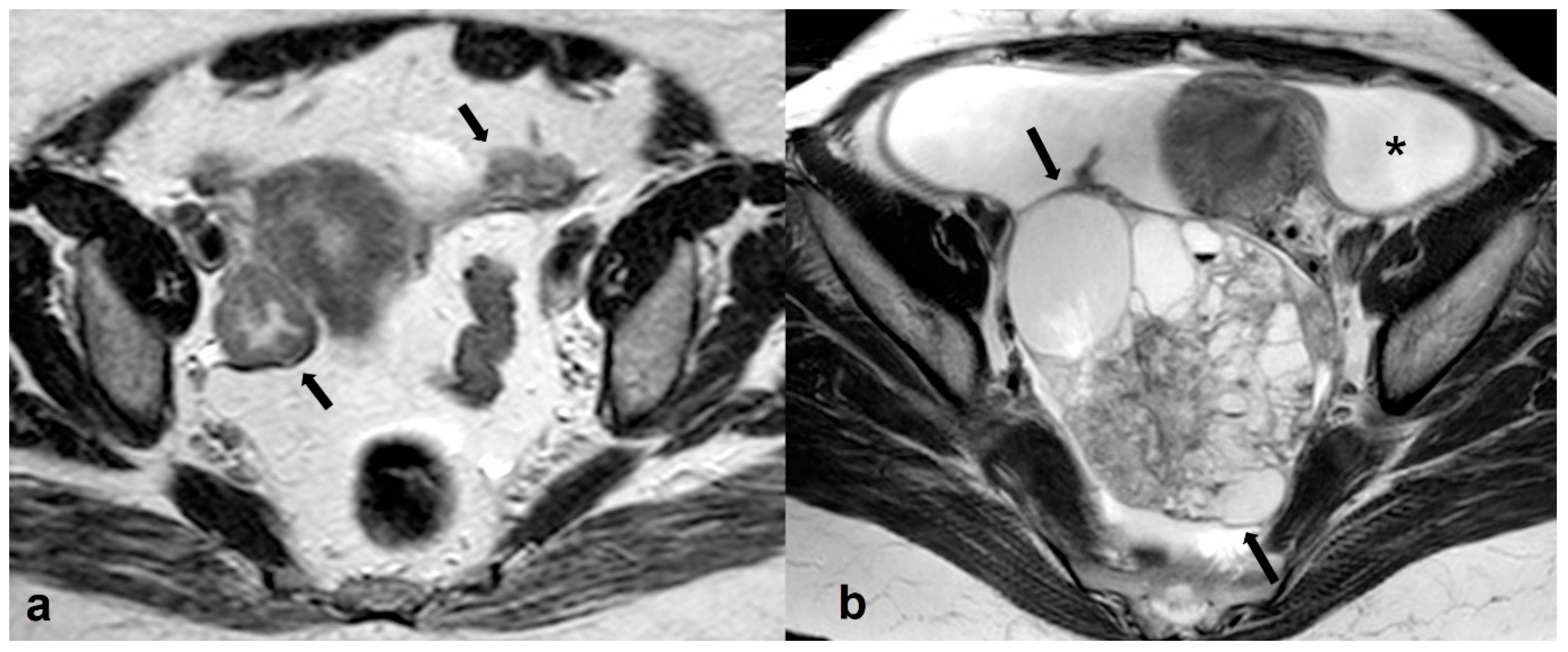 Cancers 15 02106 g016 Cancers 15 02106 g016