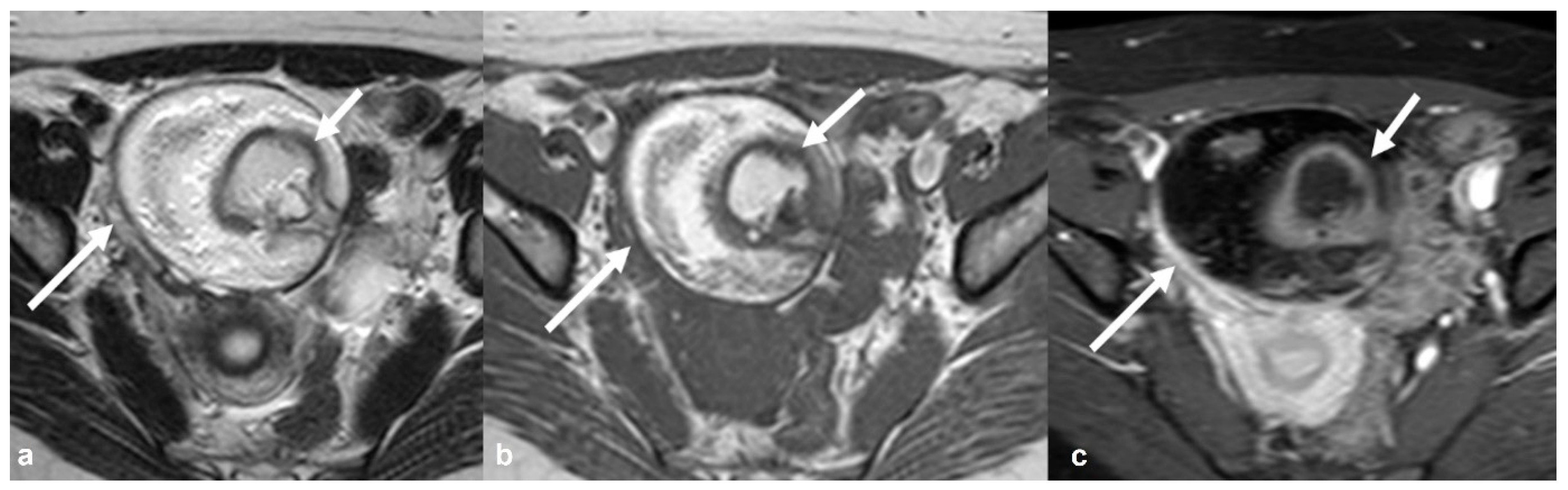 Cancers 15 02106 g017 Cancers 15 02106 g017