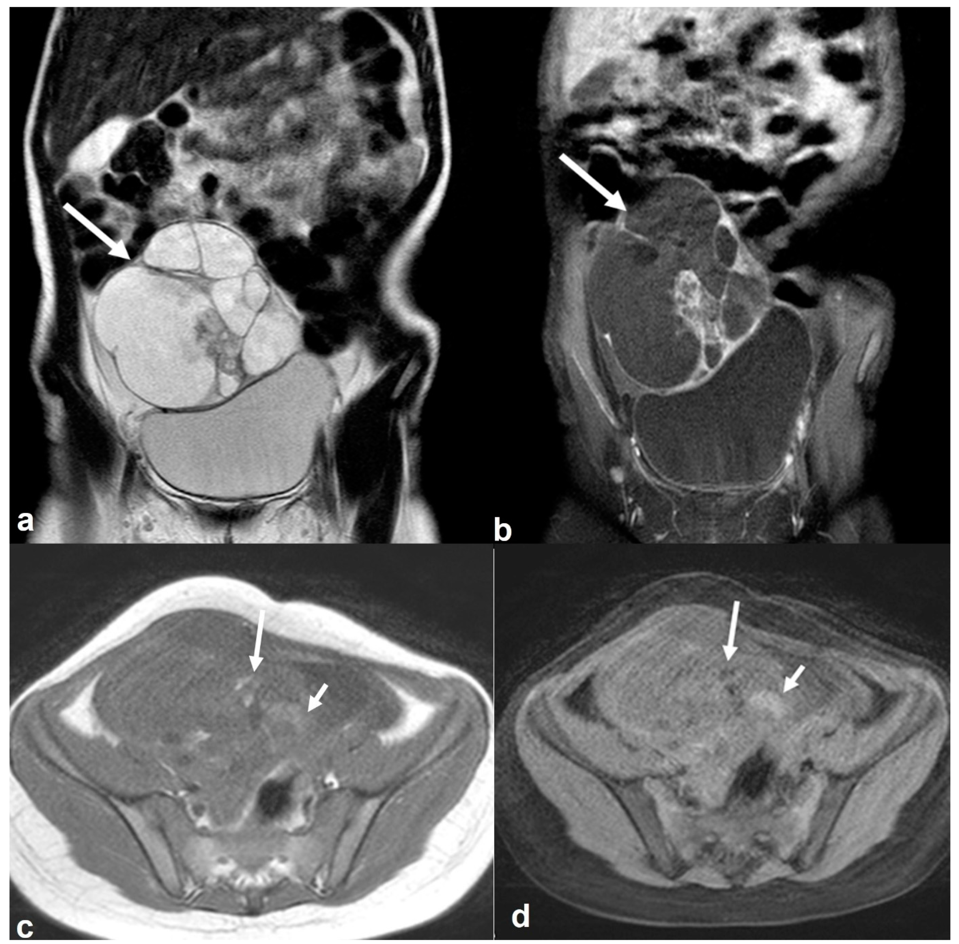 Cancers 15 02106 g018 Cancers 15 02106 g018