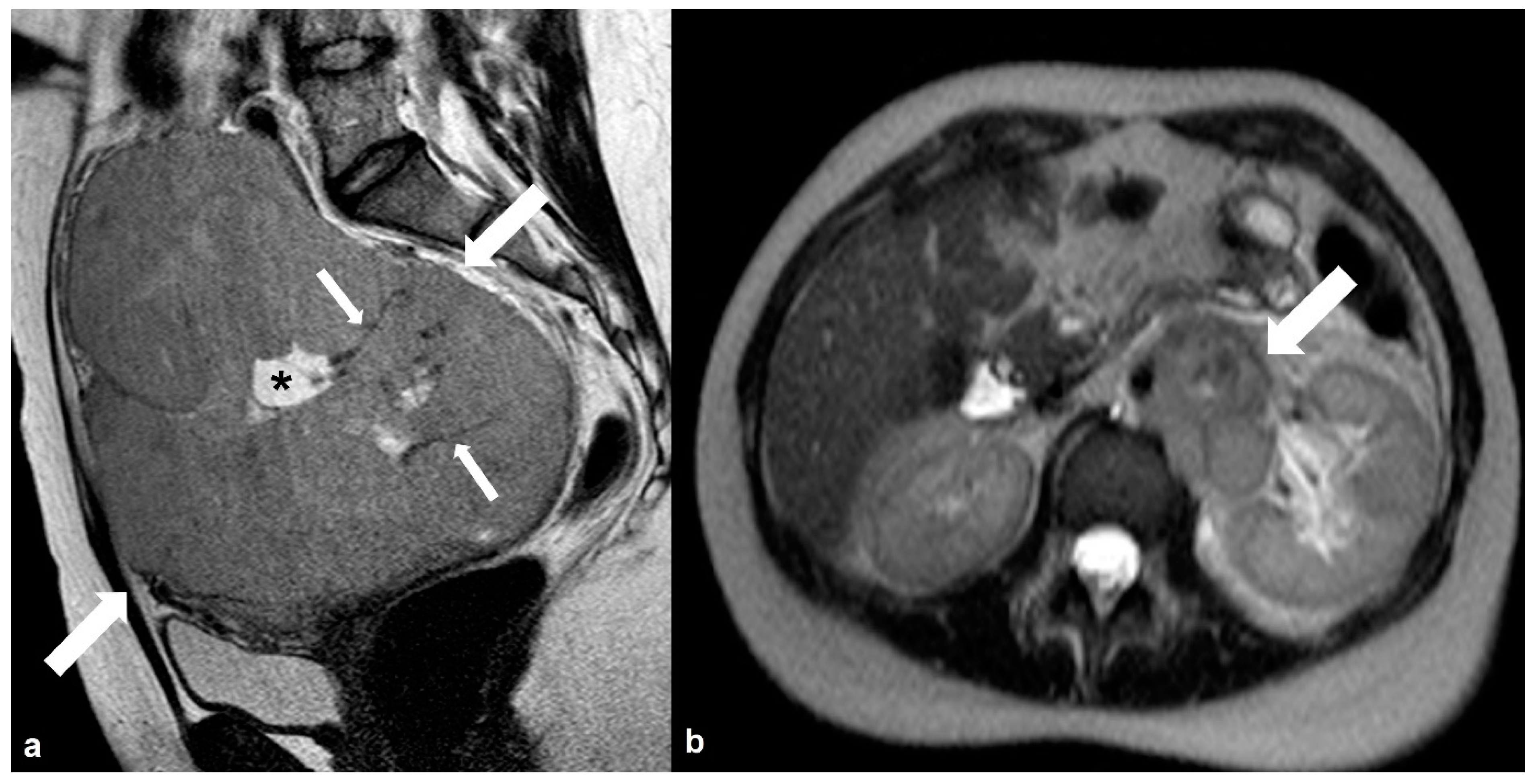 Cancers 15 02106 g019 Cancers 15 02106 g019