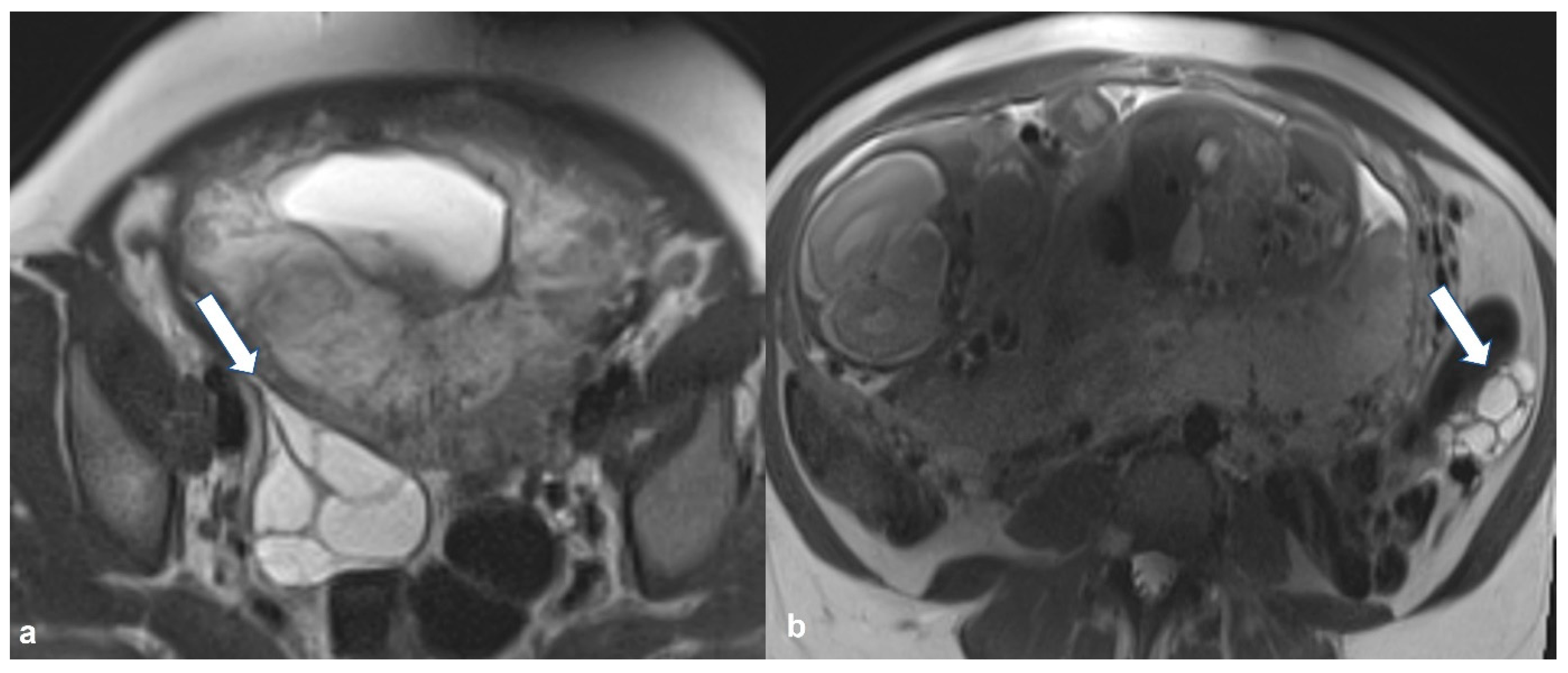 Cancers 15 02106 g020 Cancers 15 02106 g020