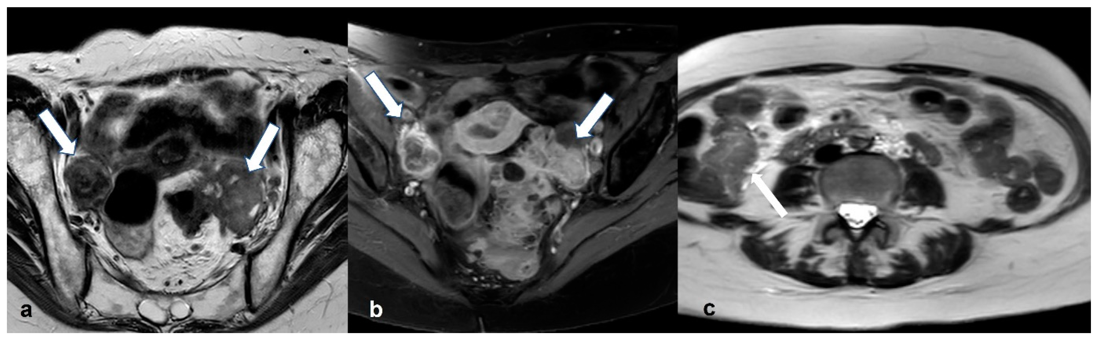 Cancers 15 02106 g022 Cancers 15 02106 g022