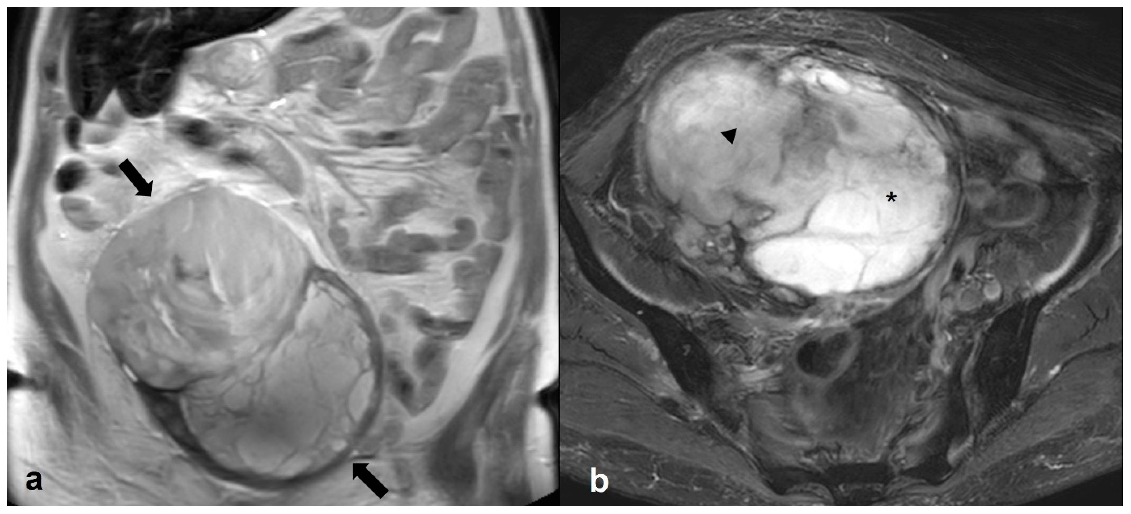 Cancers 15 02106 g023 Cancers 15 02106 g023