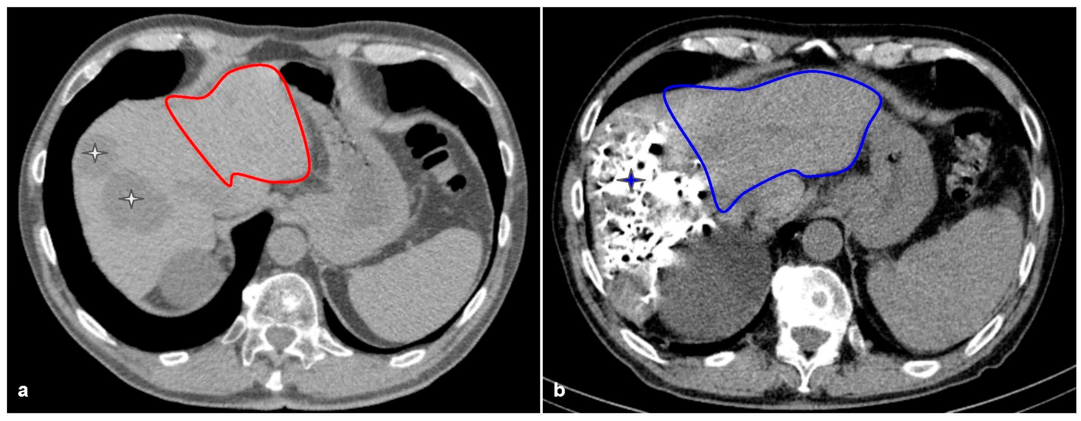 Cancers 15 02113 g001