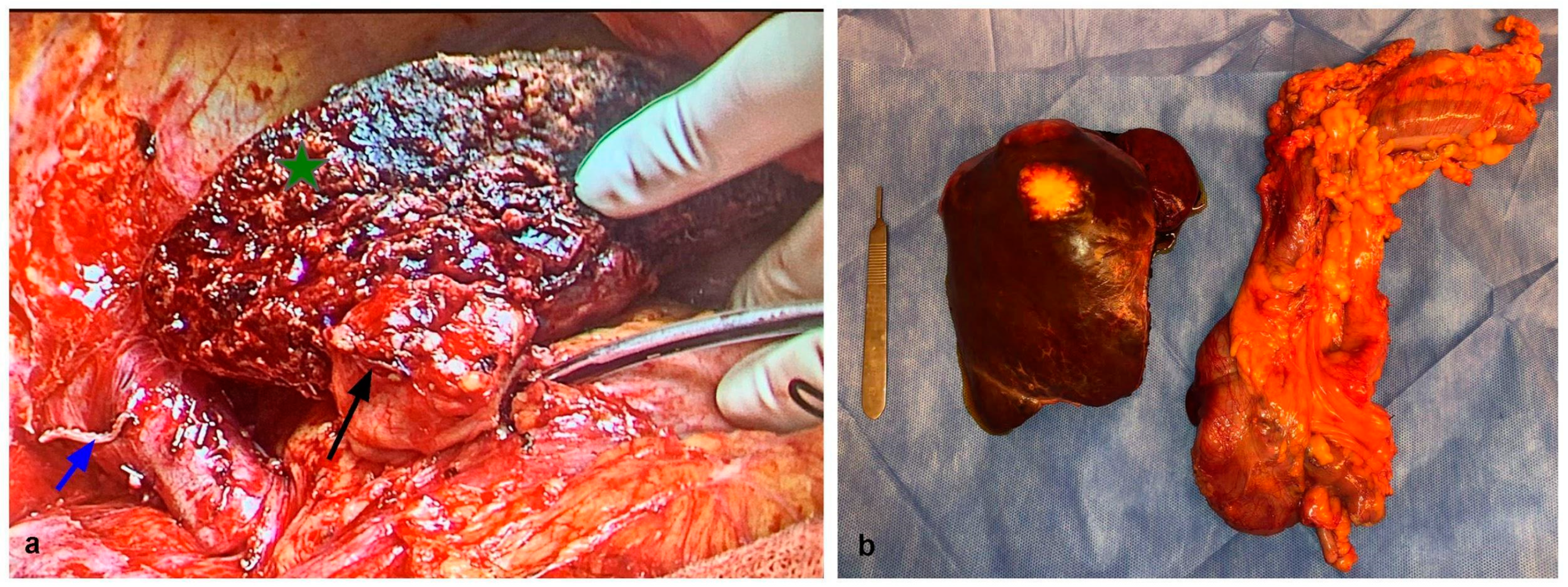 Cancers 15 02113 g002