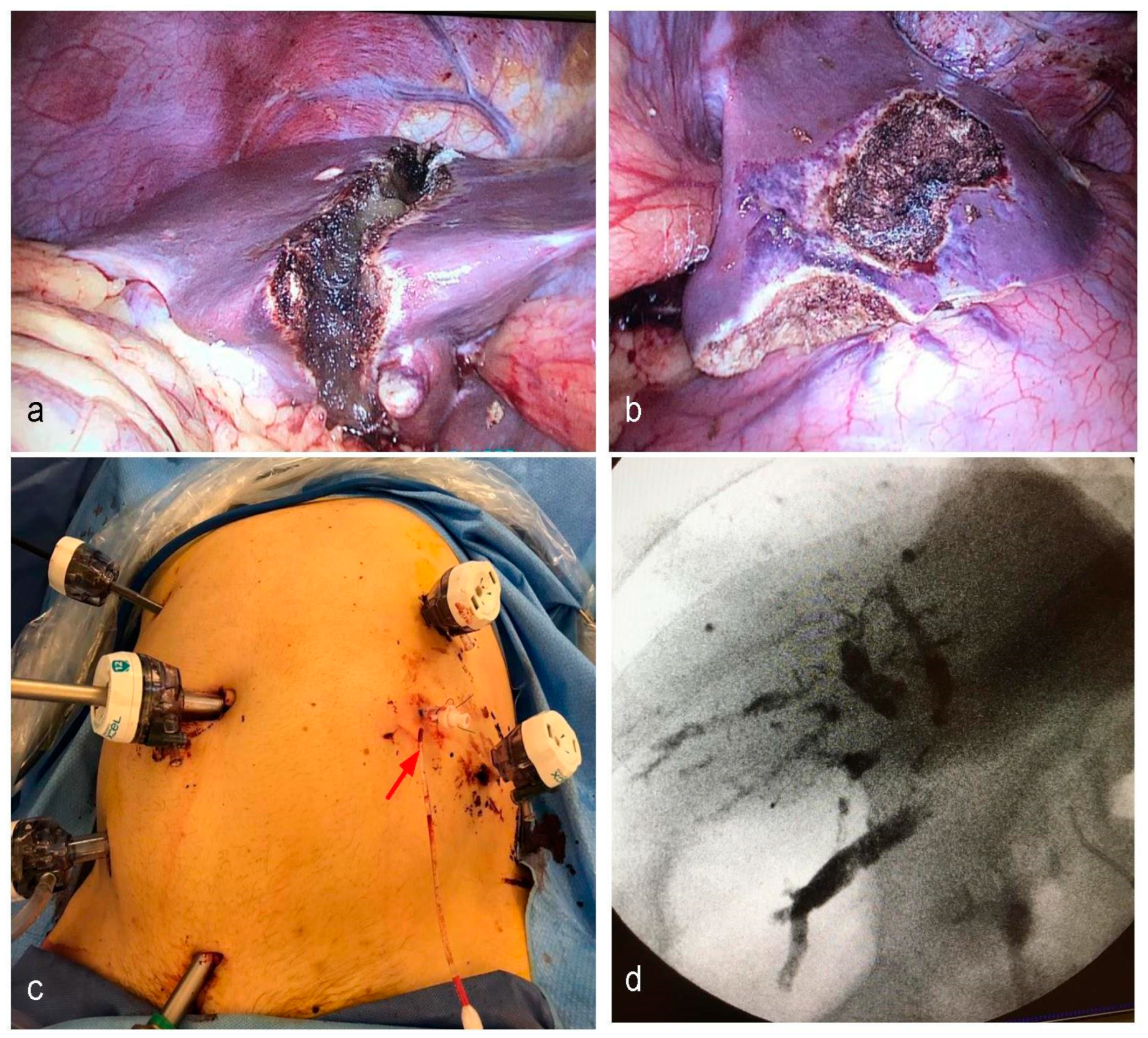 Cancers 15 02113 g003