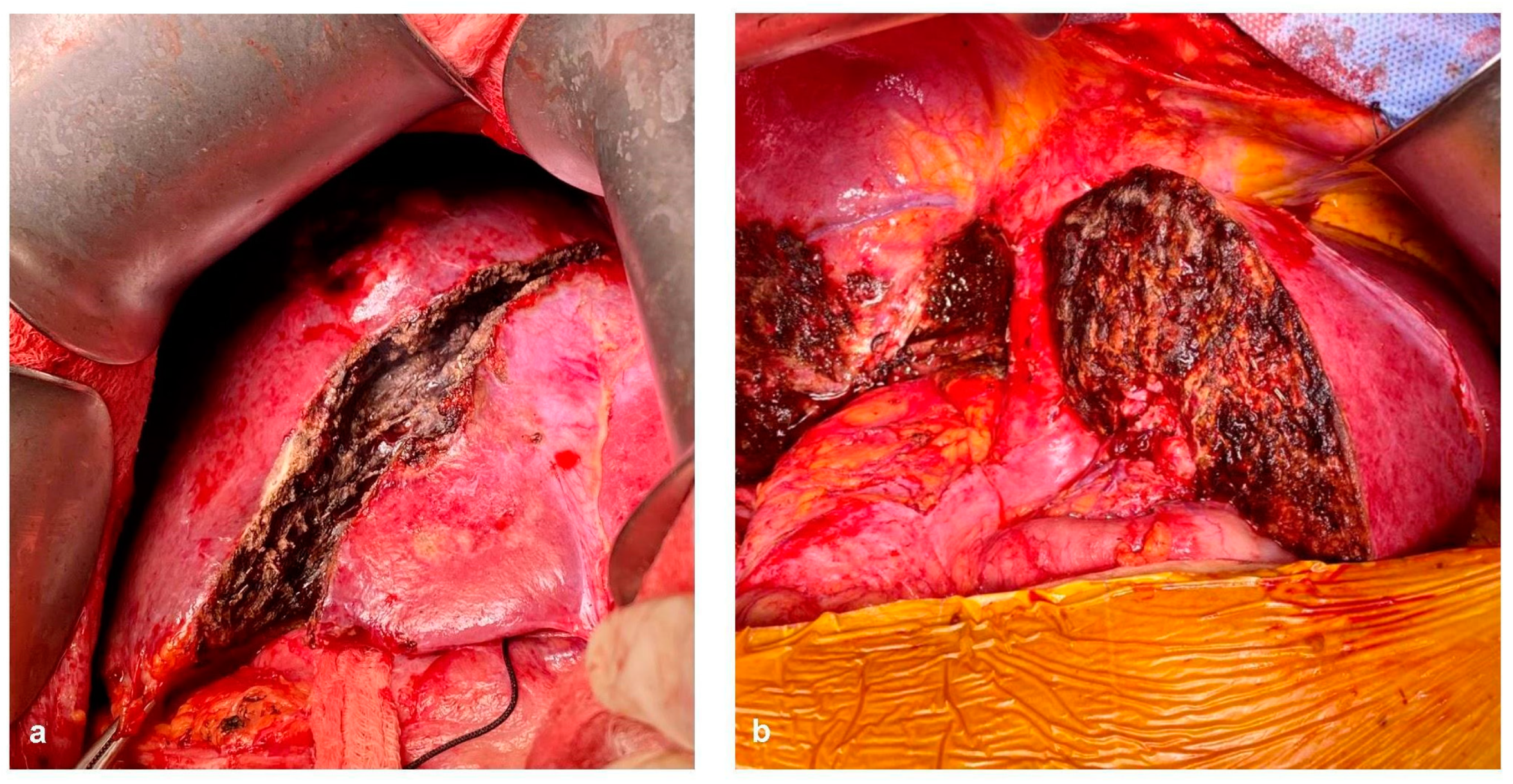 Cancers 15 02113 g004