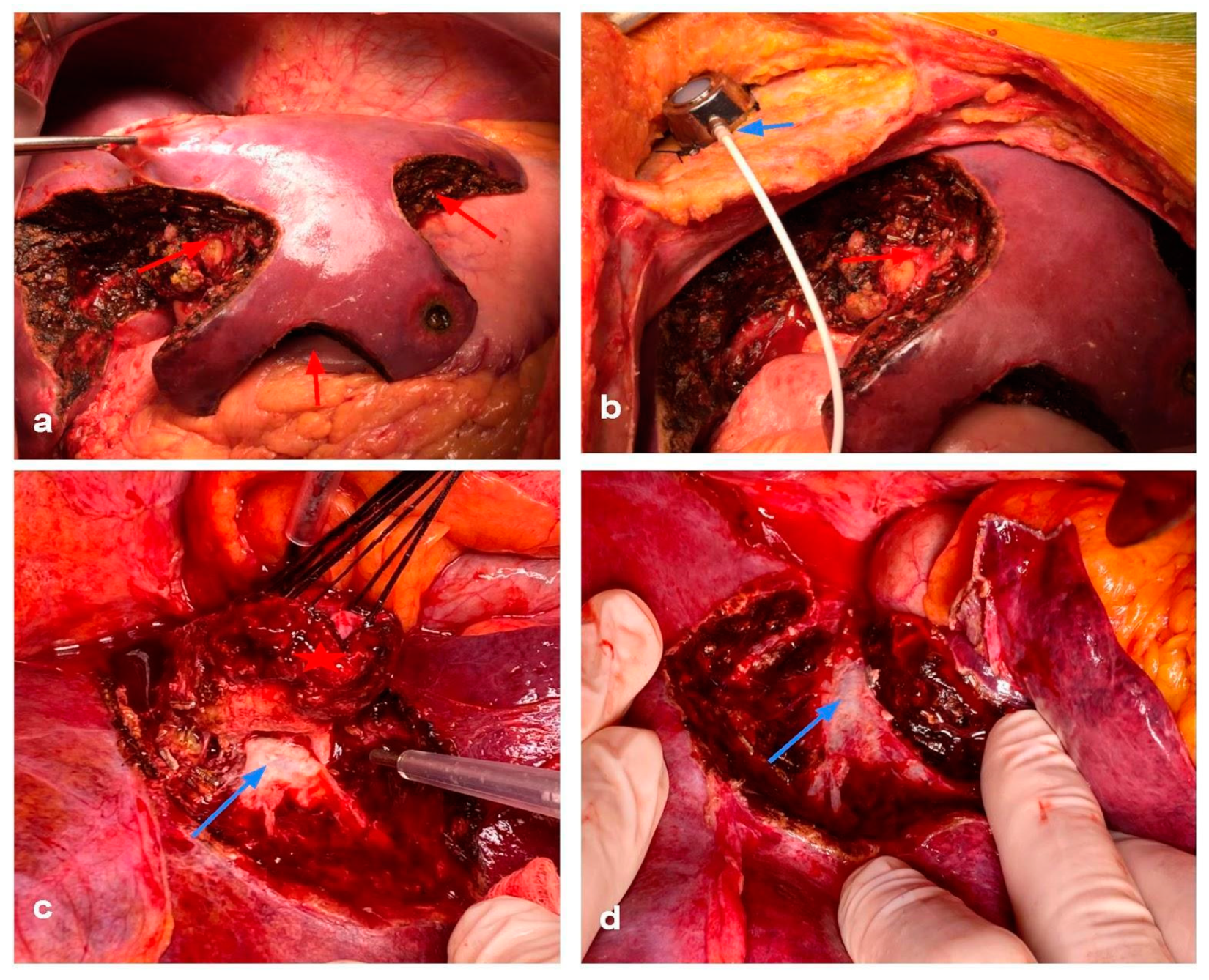 Cancers 15 02113 g005