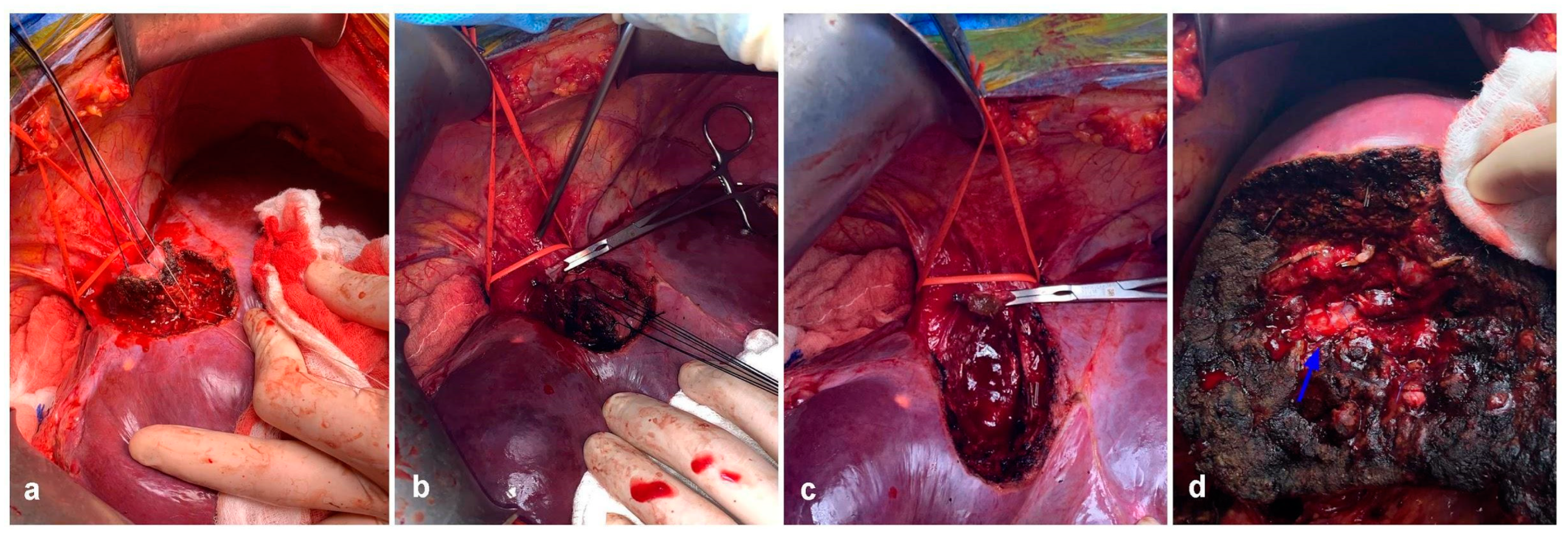 Cancers 15 02113 g006