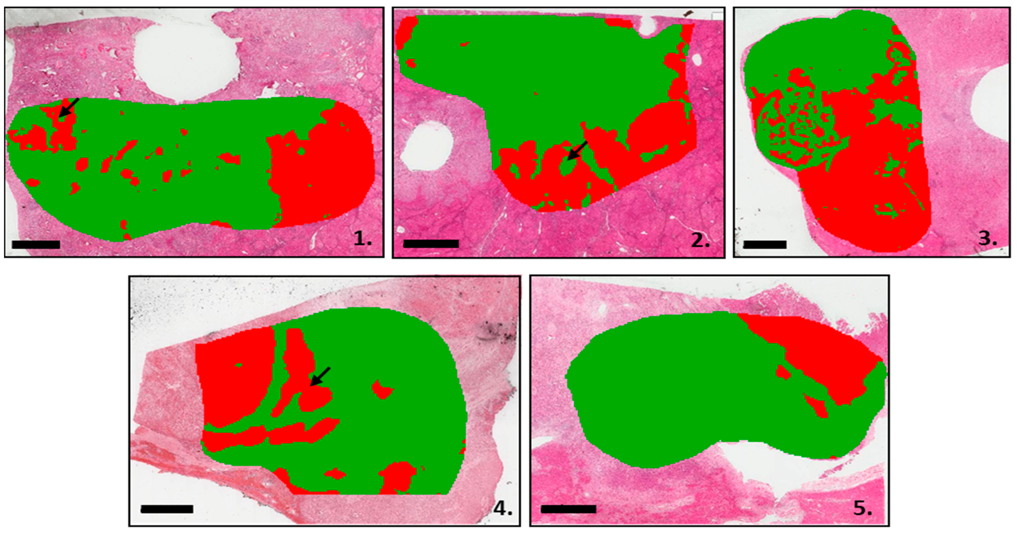 Cancers 15 02143 g001 Cancers 15 02143 g001