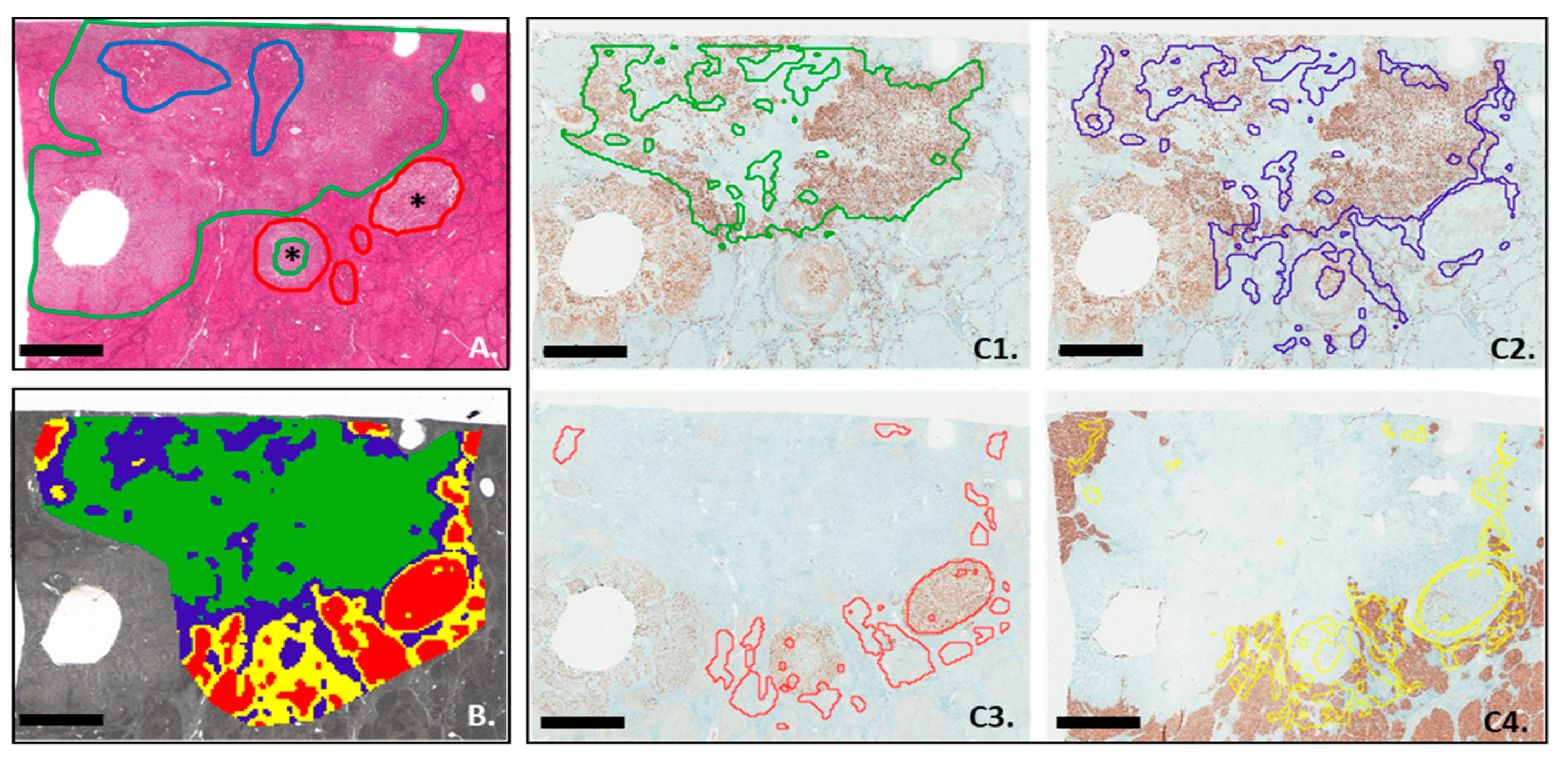 Cancers 15 02143 g004 Cancers 15 02143 g004