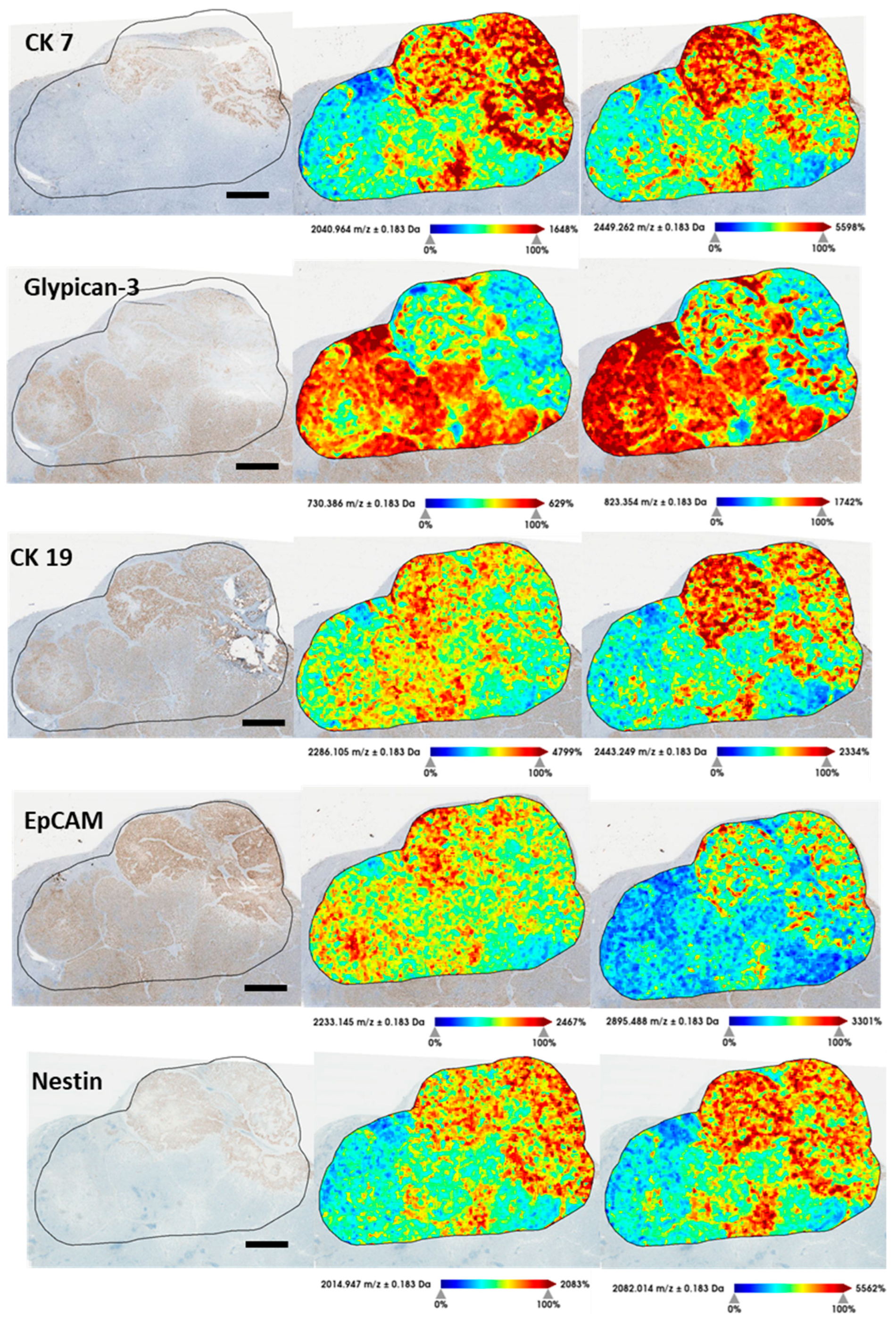 Cancers 15 02143 g005 Cancers 15 02143 g005