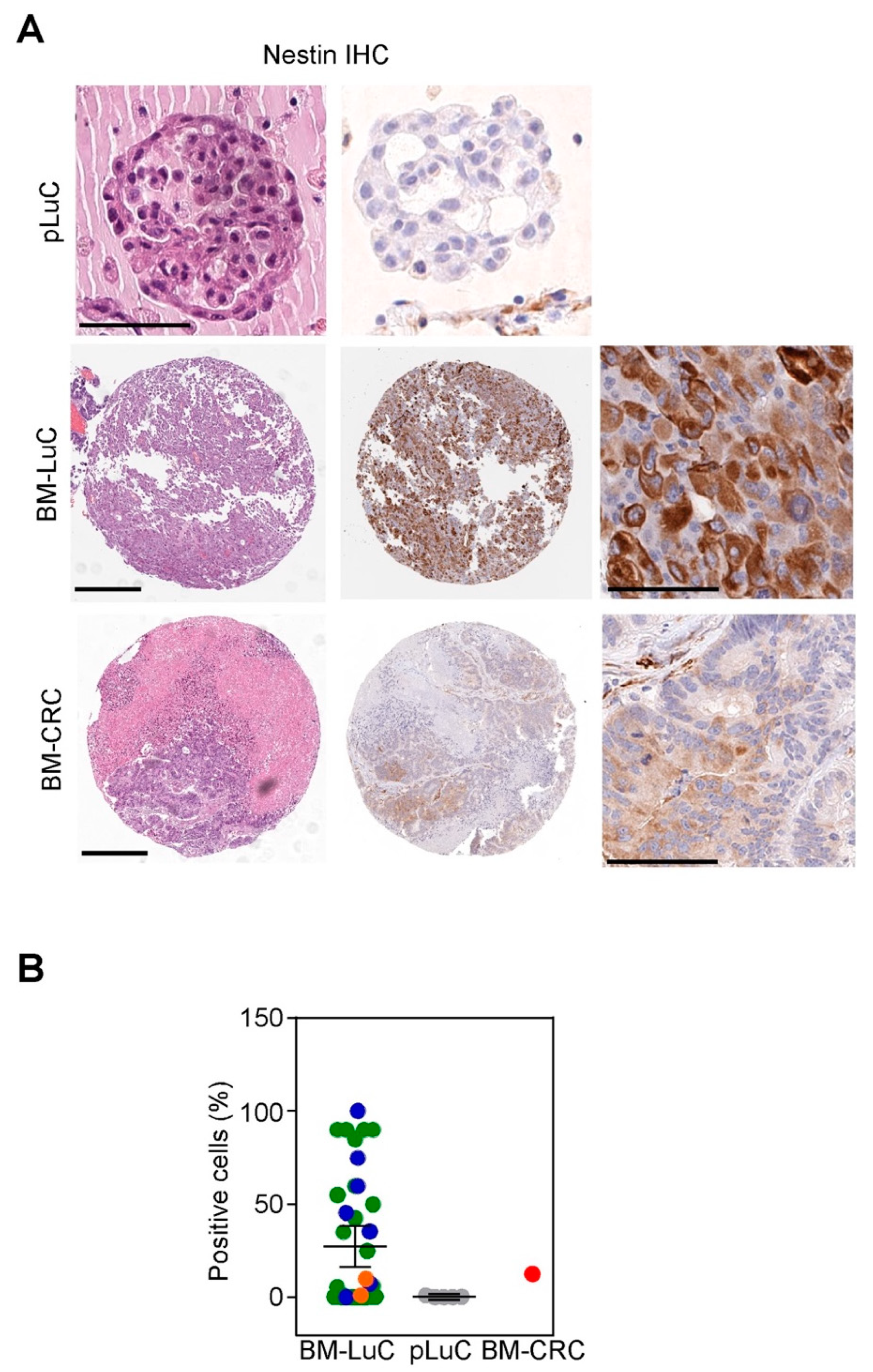 Cancers 15 02145 g003 Cancers 15 02145 g003