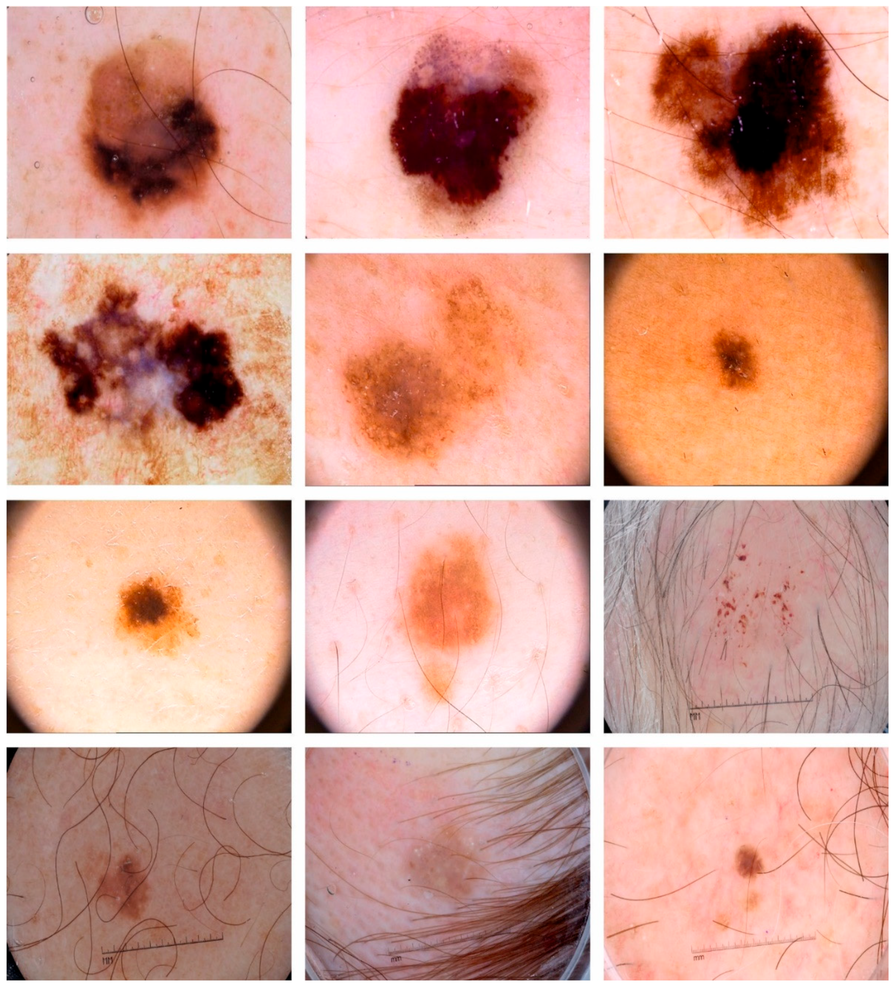 Cancers 15 02146 g004 Cancers 15 02146 g004