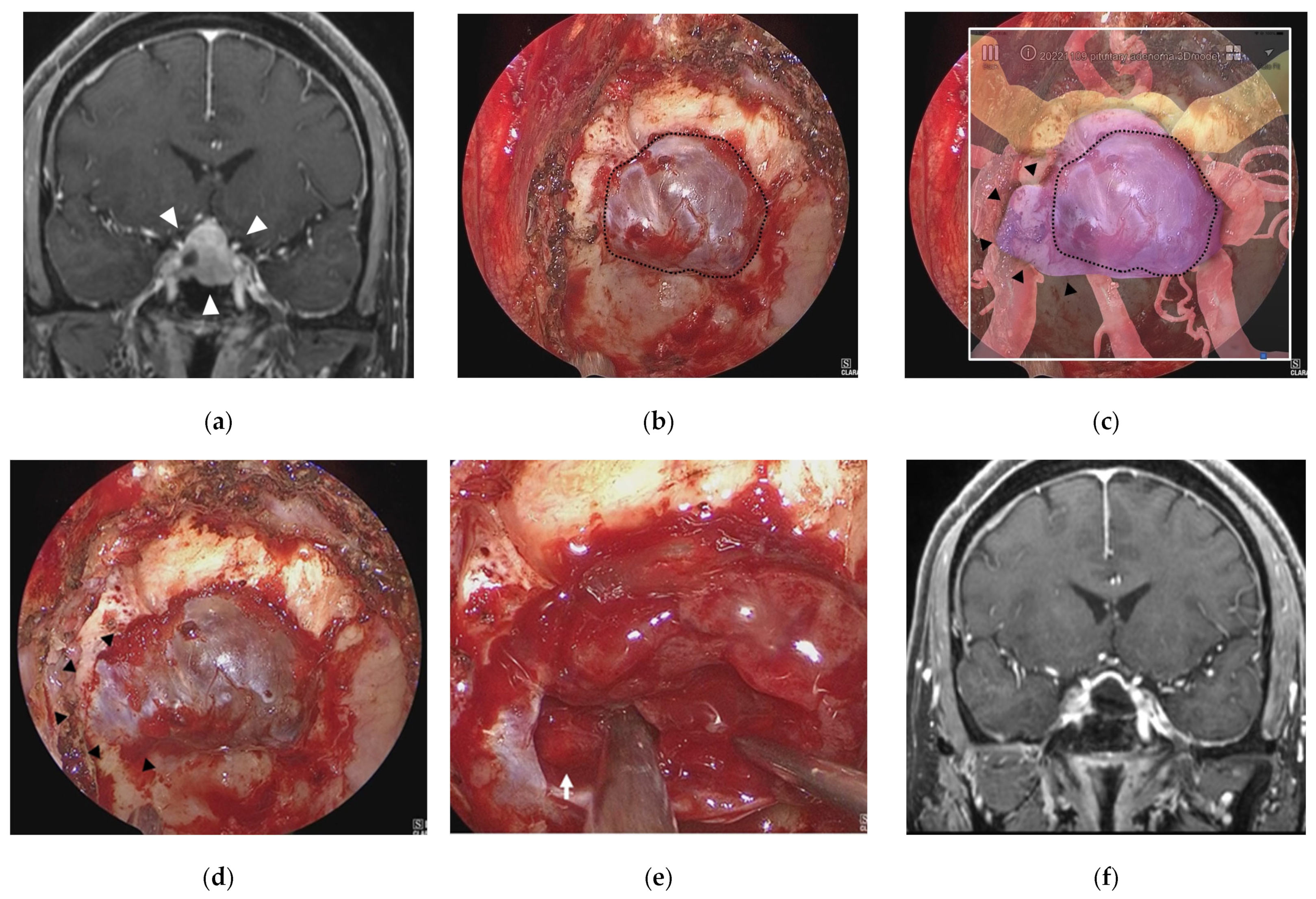Cancers 15 02148 g004 Cancers 15 02148 g004