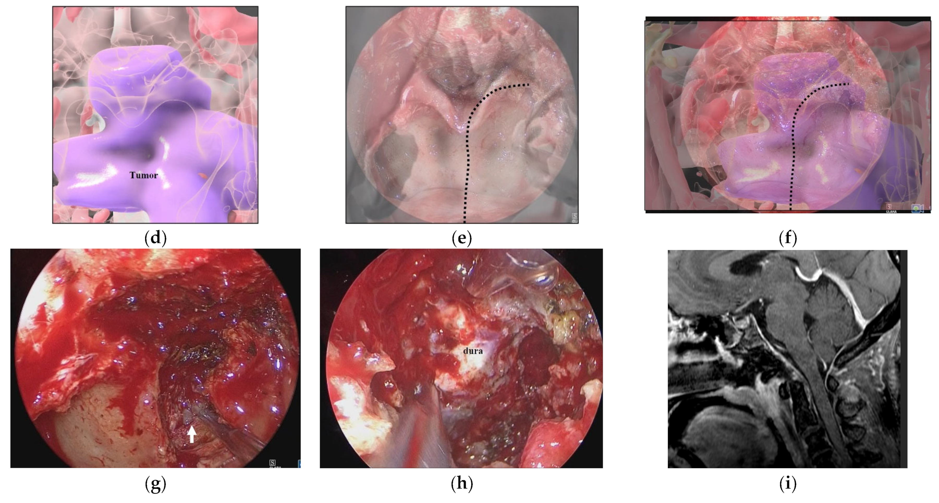 Cancers 15 02148 g005b Cancers 15 02148 g005b
