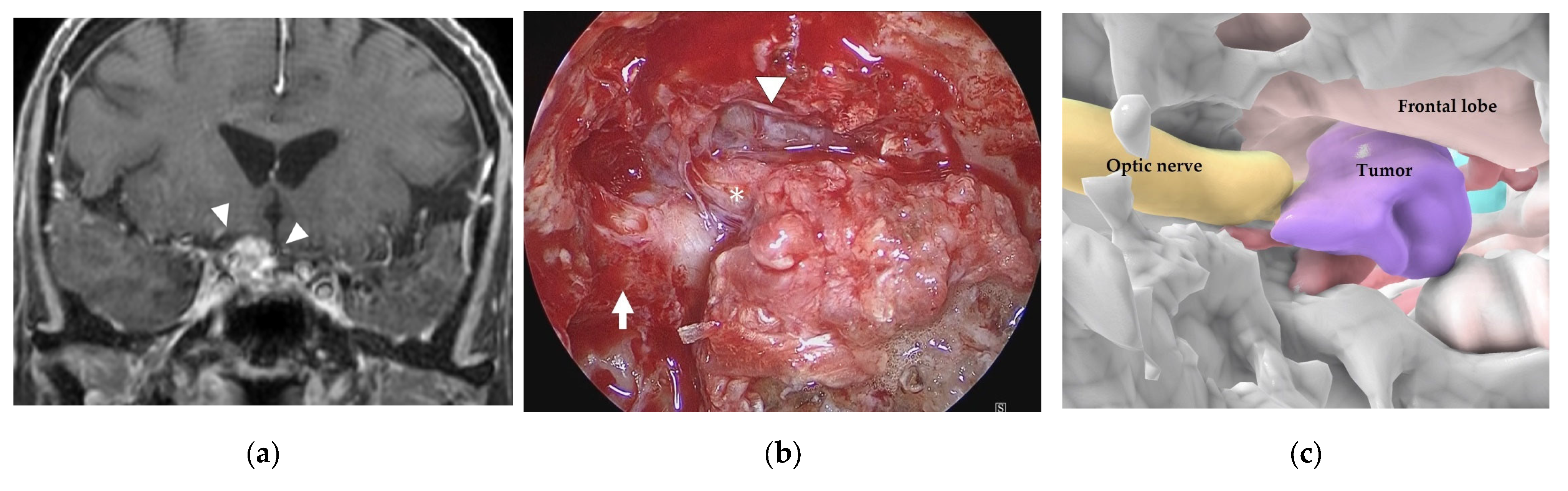 Cancers 15 02148 g006a Cancers 15 02148 g006a