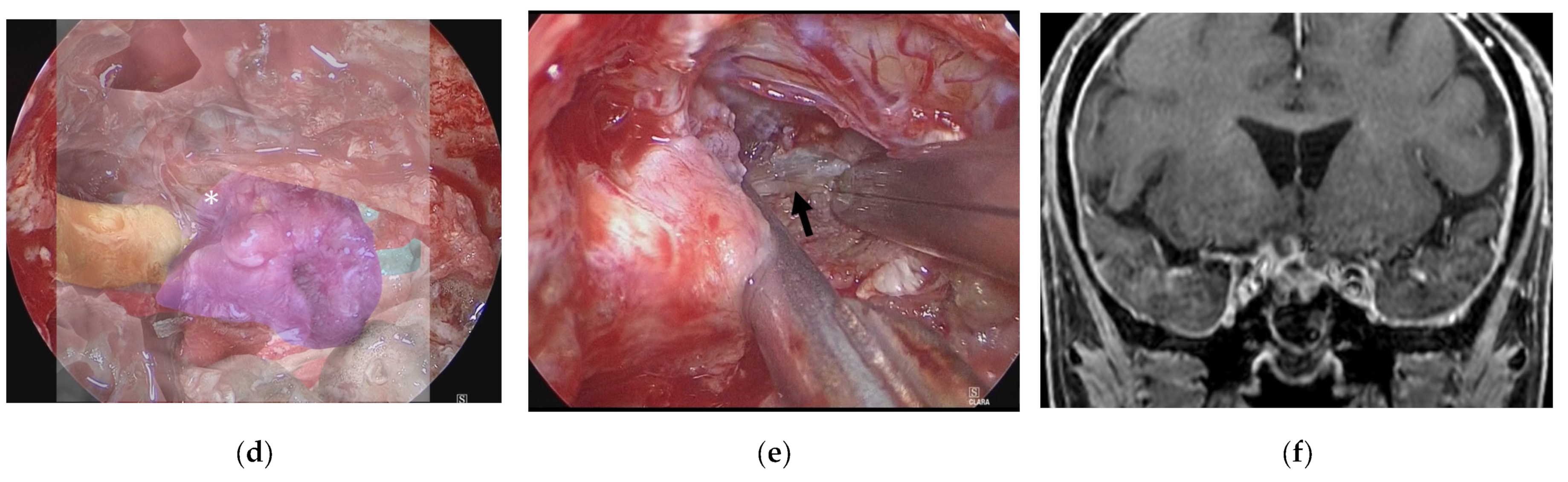 Cancers 15 02148 g006b Cancers 15 02148 g006b