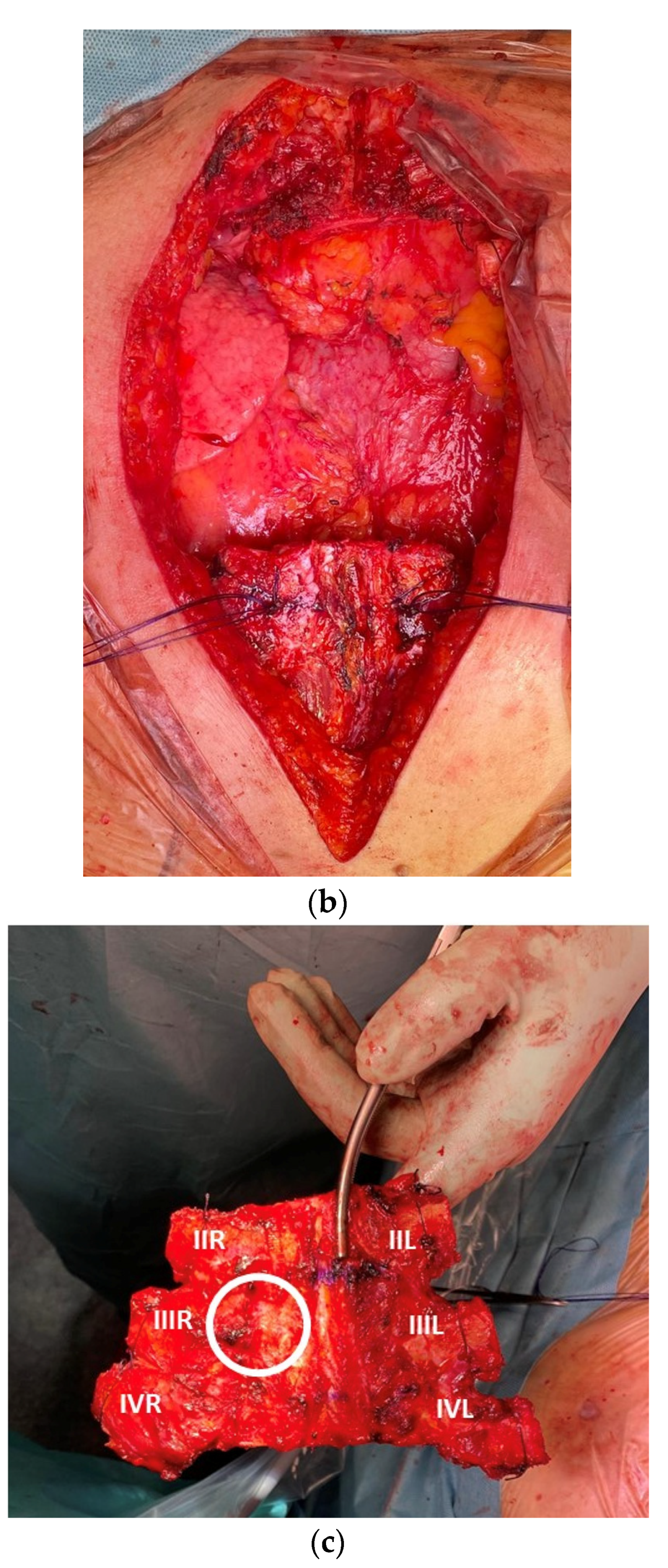 Cancers 15 02153 g005b