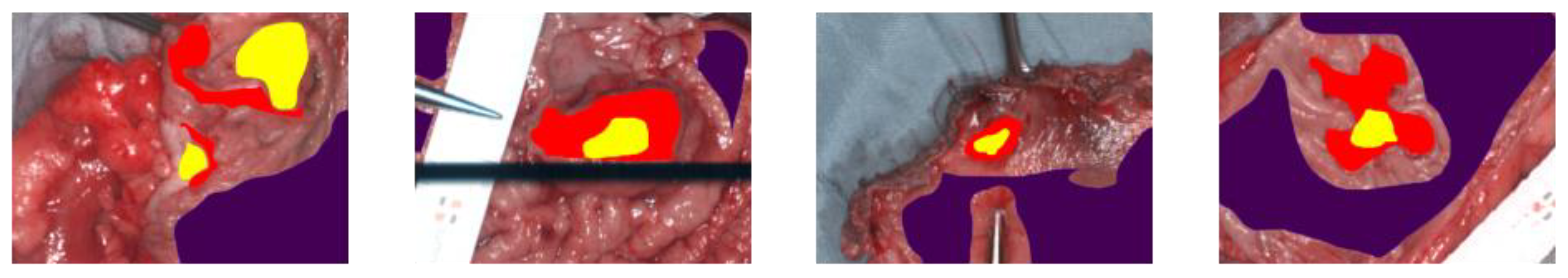 Cancers 15 02157 g001 Cancers 15 02157 g001