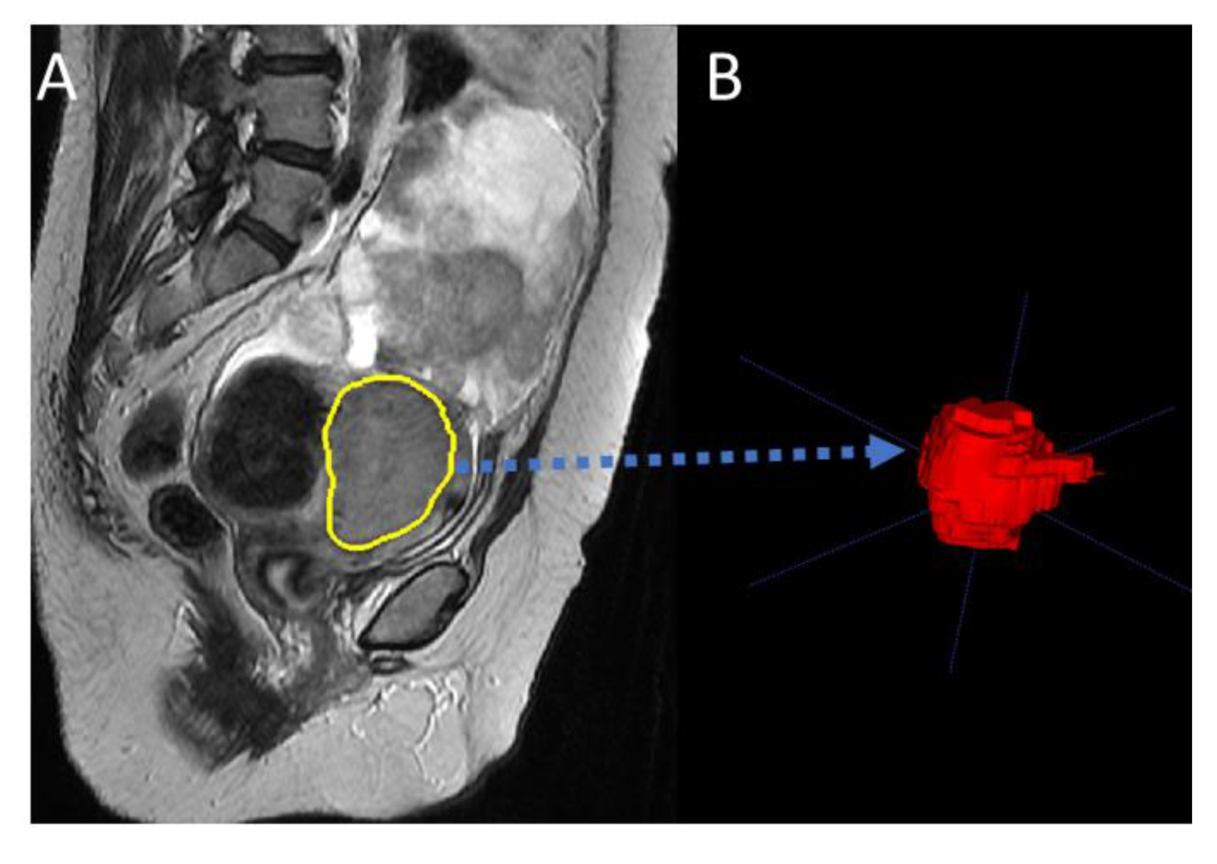 Cancers 15 02209 g002 Cancers 15 02209 g002