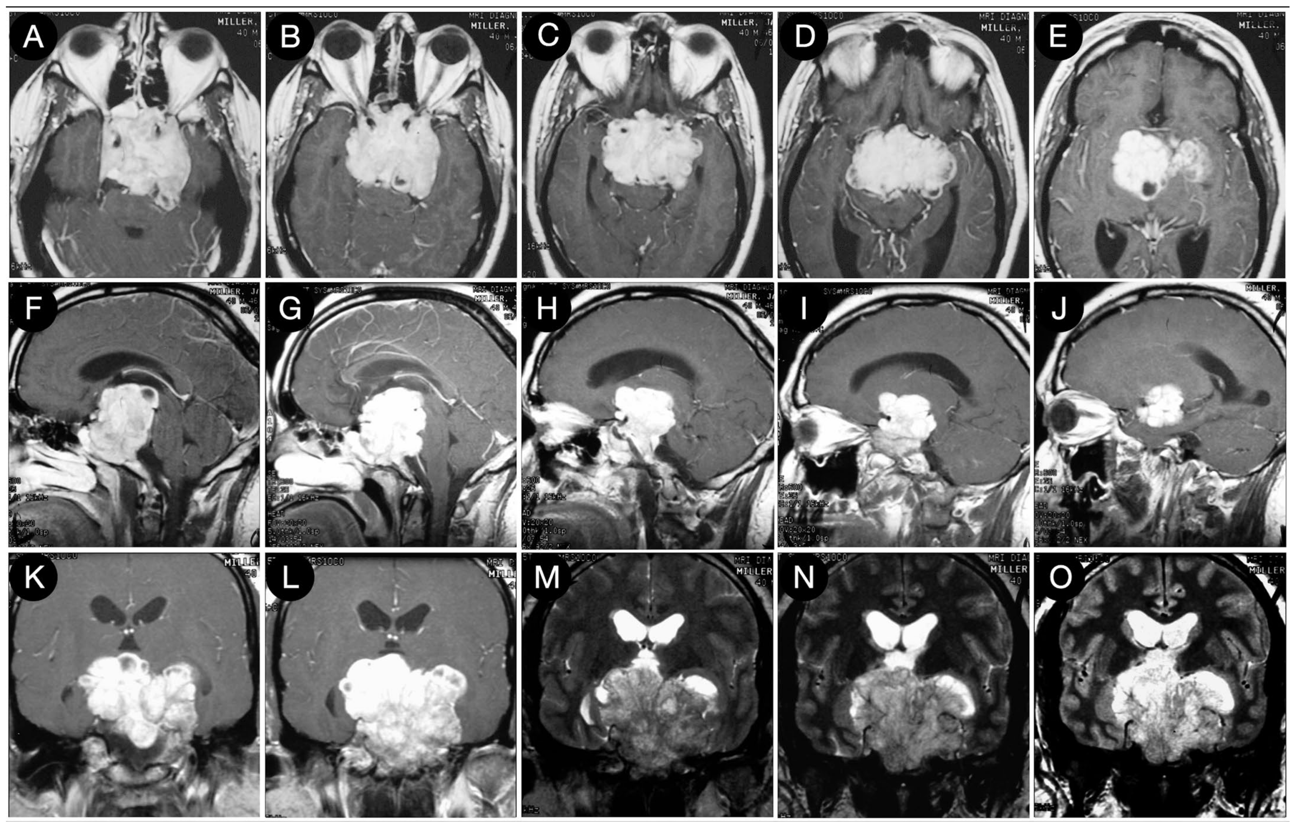 Cancers 15 02235 g003 Cancers 15 02235 g003
