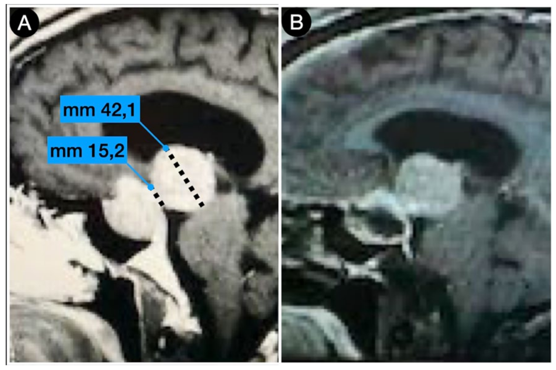 Cancers 15 02235 g004 Cancers 15 02235 g004