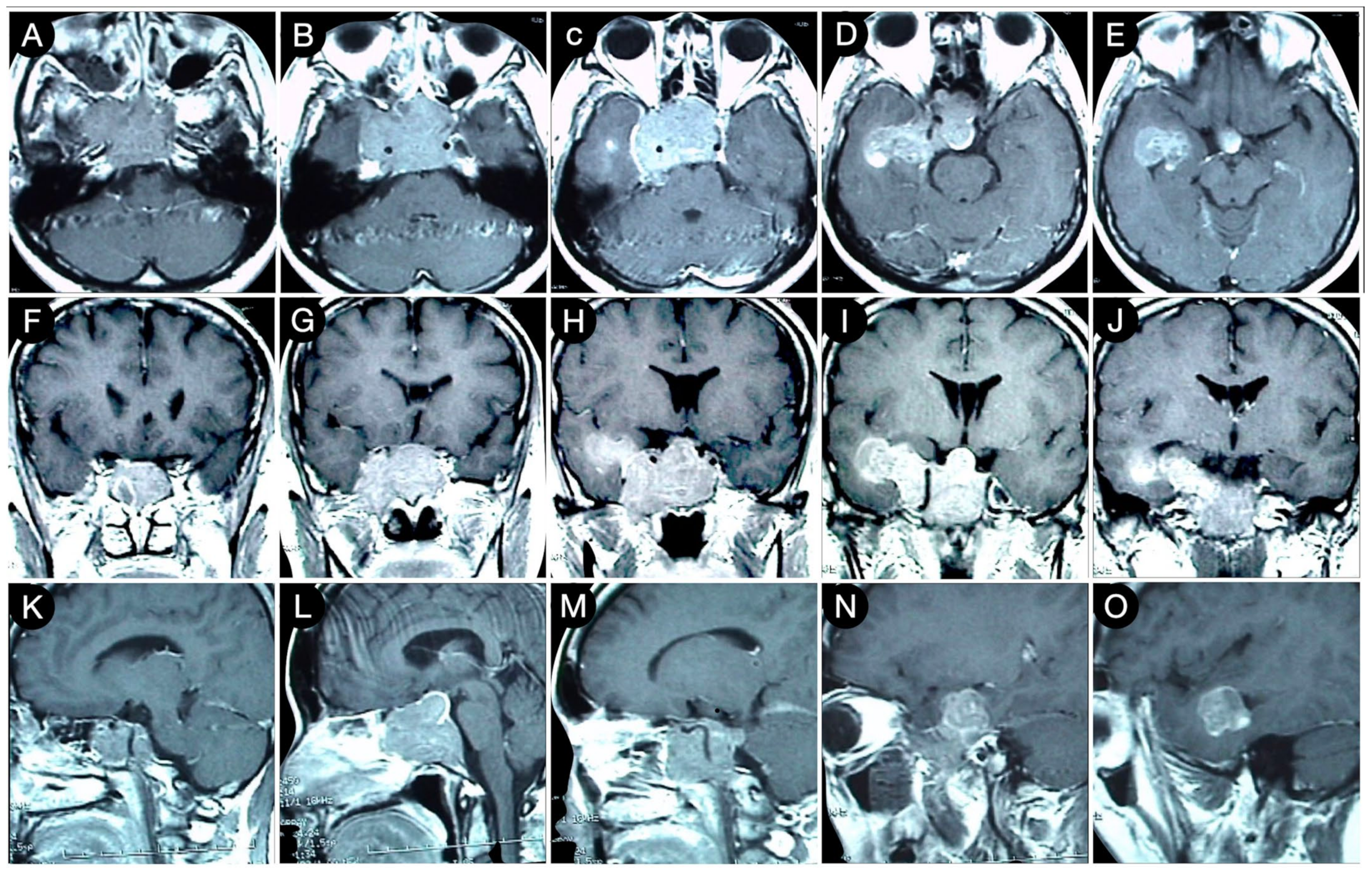 Cancers 15 02235 g005 Cancers 15 02235 g005