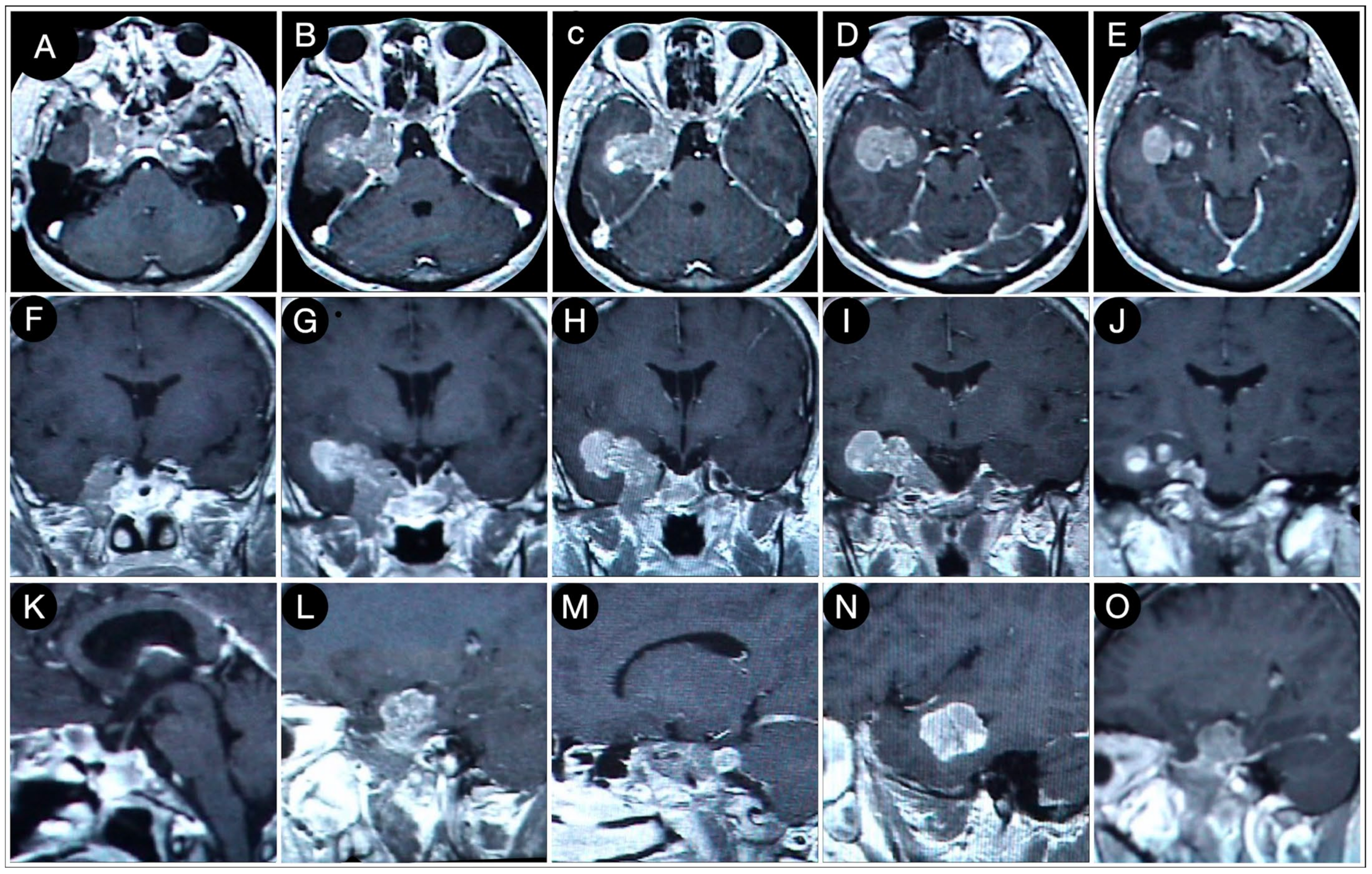 Cancers 15 02235 g007 Cancers 15 02235 g007