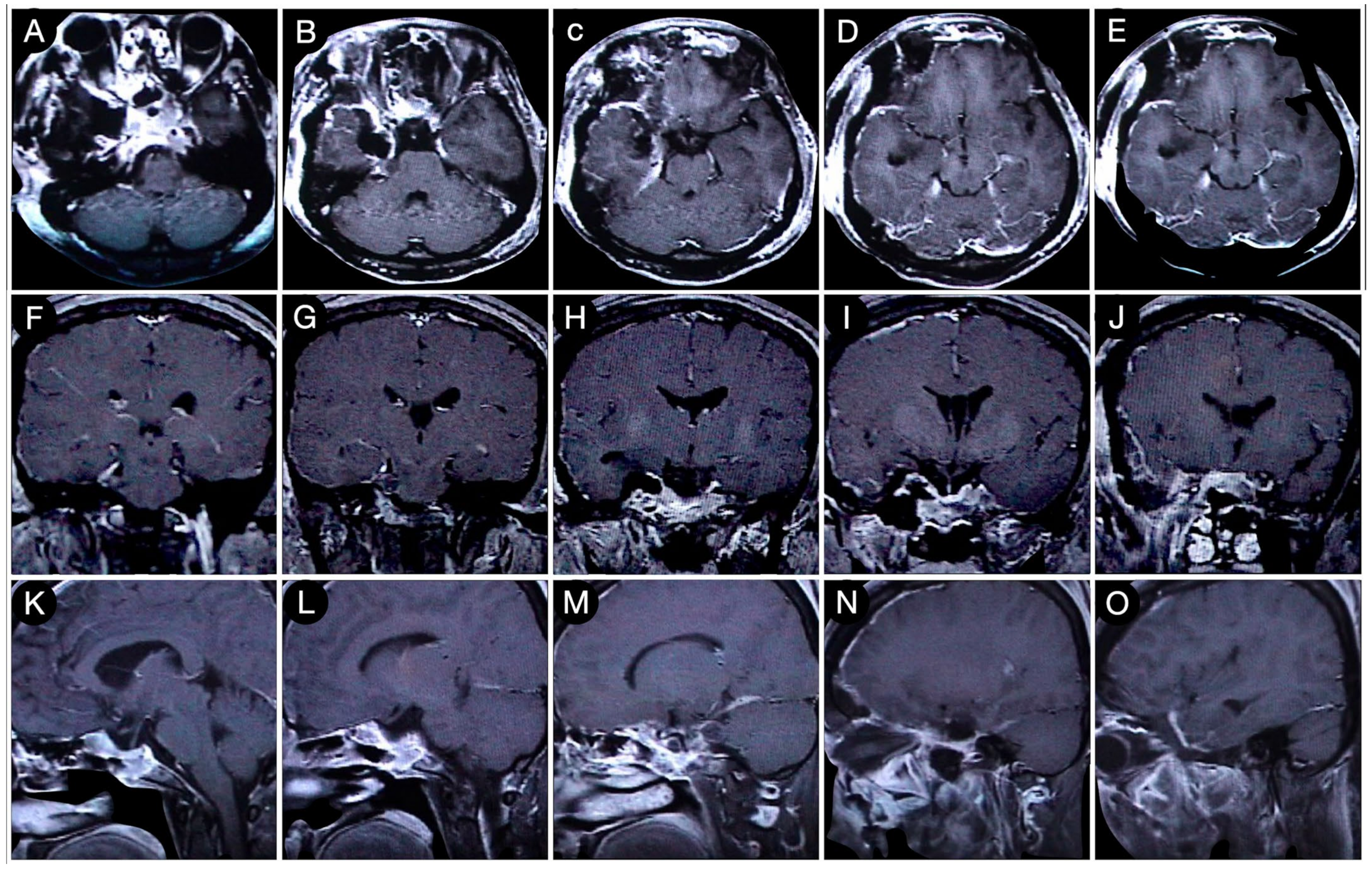 Cancers 15 02235 g008 Cancers 15 02235 g008
