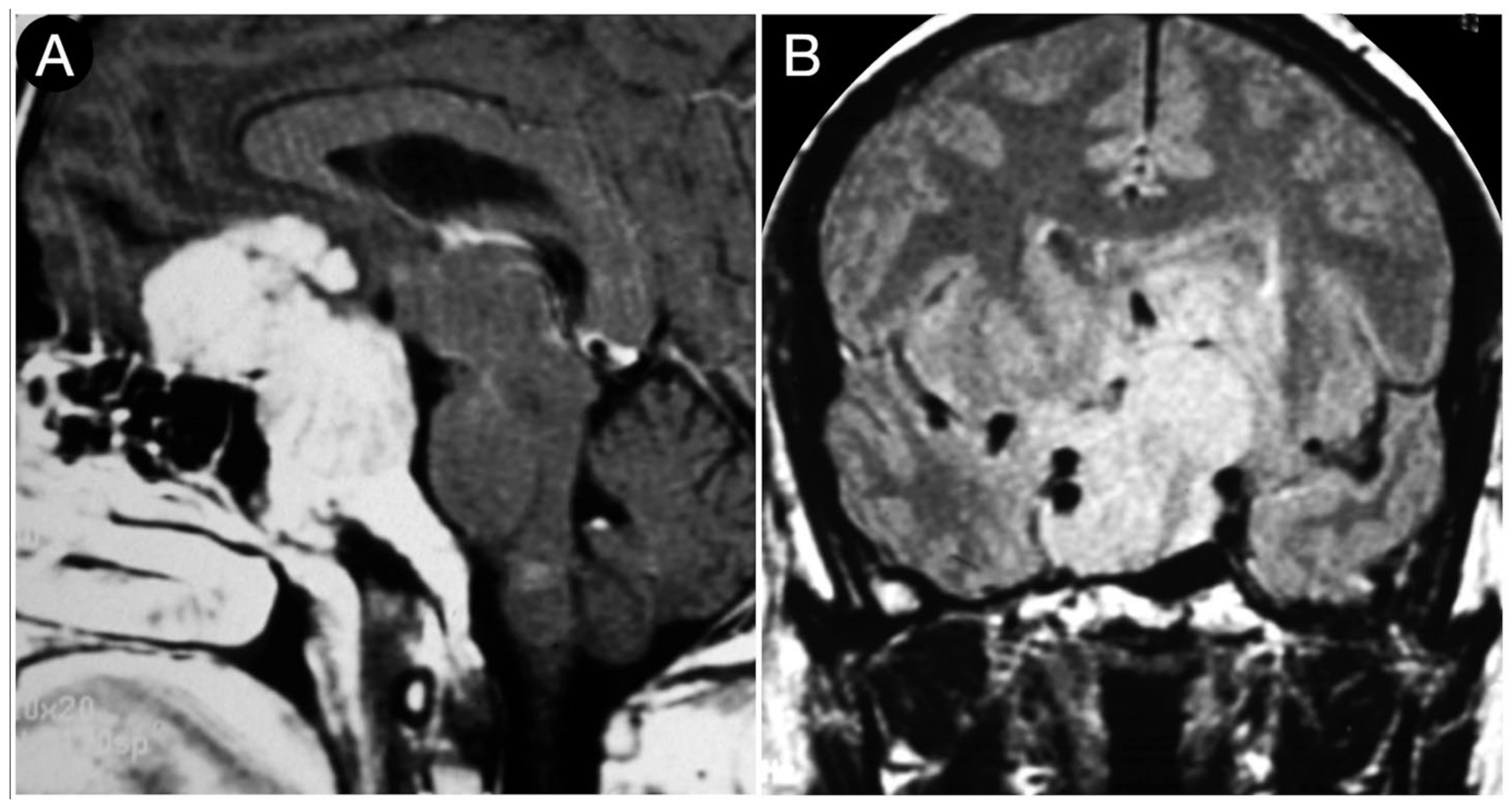Cancers 15 02235 g009 Cancers 15 02235 g009